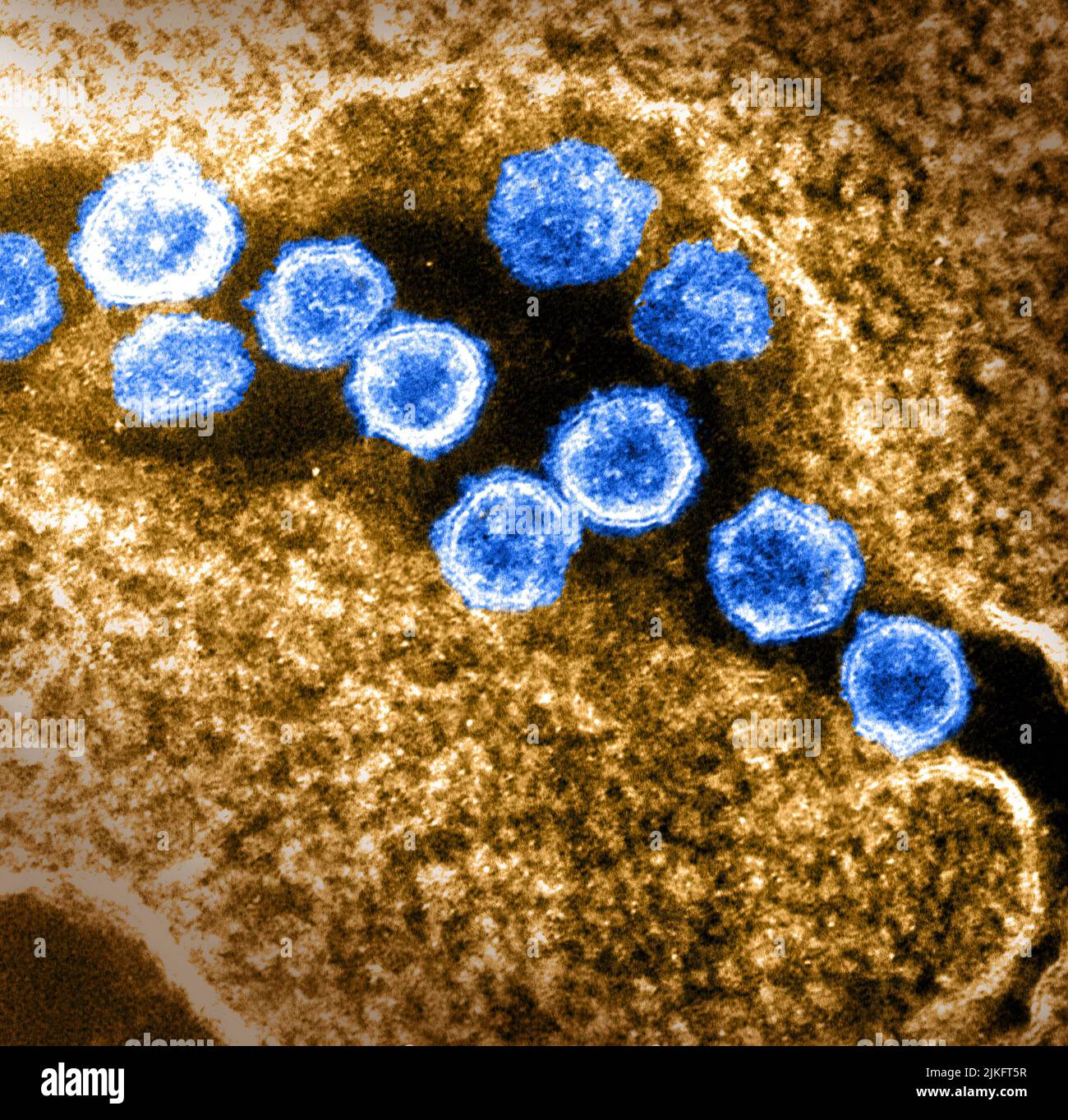 Cette image au microscope électronique à transmission montre le SRAS-COV-2, également connu sous le nom de 2019-nCoV, le virus qui cause le COVID-19. Les particules virales émergent de la surface d'une cellule cultivée en laboratoire. Les pointes sur le bord extérieur des particules virales donnent aux coronavirus leur nom, en forme de couronne. Image capturée et colorisée aux laboratoires Rocky Mountain à Hamilton, Montana. Crédit : NIAID Banque D'Images