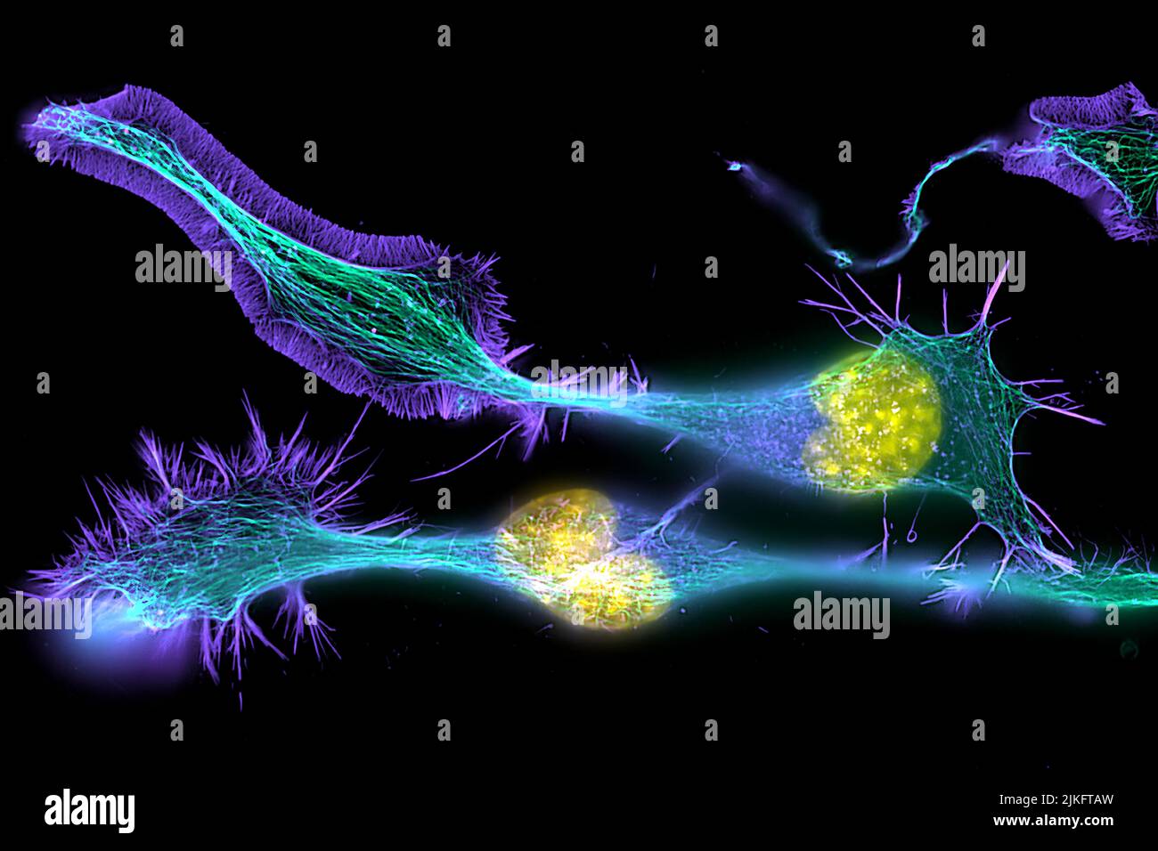 Ces cellules nerveuses de souris en développement ont un noyau (jaune) entouré d'un corps cellulaire, avec de longues extensions appelées axones et de minces structures ramifiées appelées dendrites. Les signaux électriques se déplacent de l'axone d'une cellule aux dendrites d'une autre. Banque D'Images
