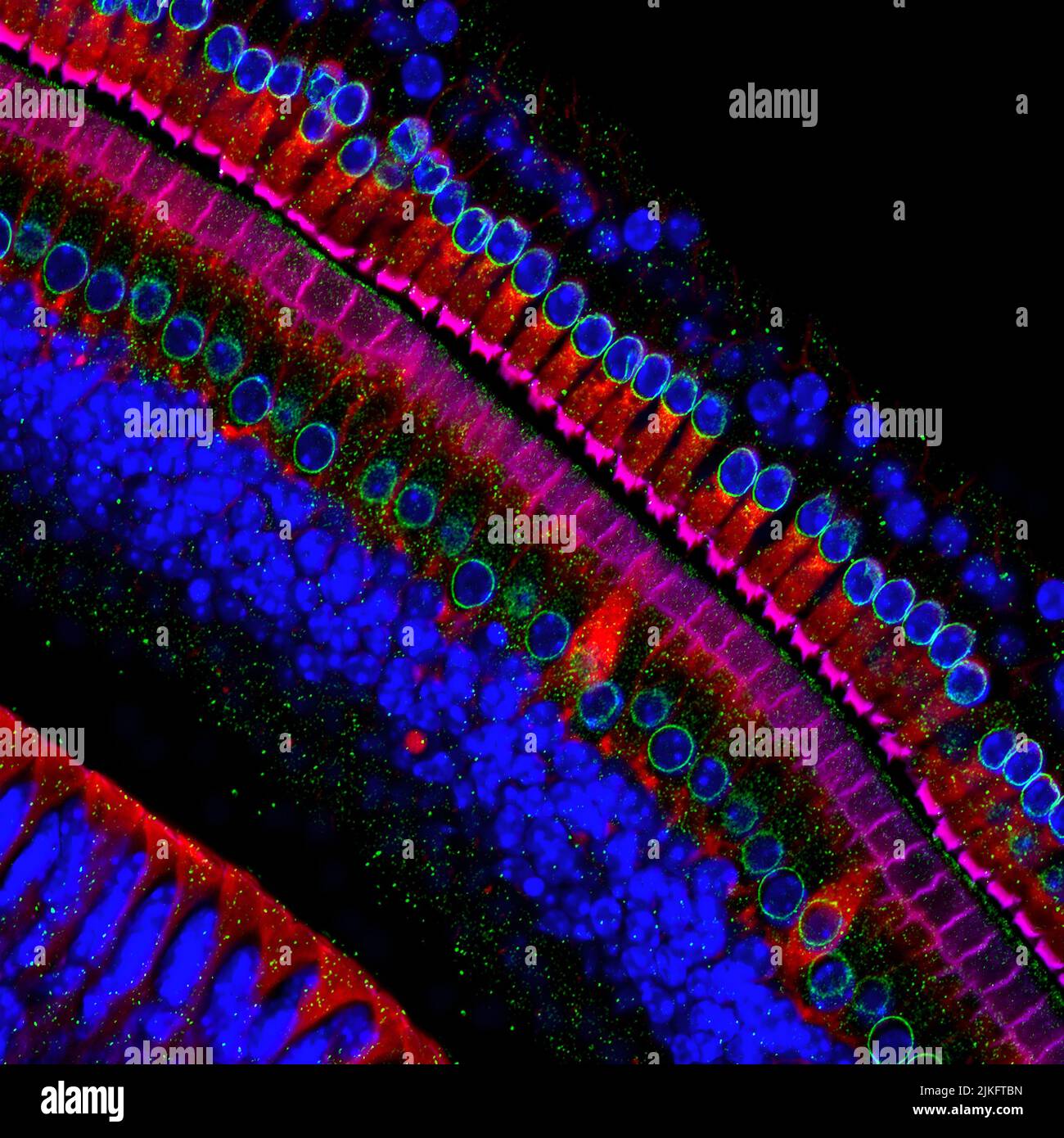 Ces cellules obtiennent leur nom des structures capillaires qui s'étendent d'elles dans le tube rempli de liquide de l'oreille interne. Lorsque le son atteint l'oreille, les poils se plient et les cellules convertissent ce mouvement en signaux transmis au cerveau. Lorsque nous faisons monter la musique dans nos voitures ou que nous rejoignons des dizaines de milliers de fans qui applaudissent dans un stade de football, le bruit peut provoquer des pincements et des bris de cheveux, ce qui entraîne une perte auditive à long terme. Banque D'Images