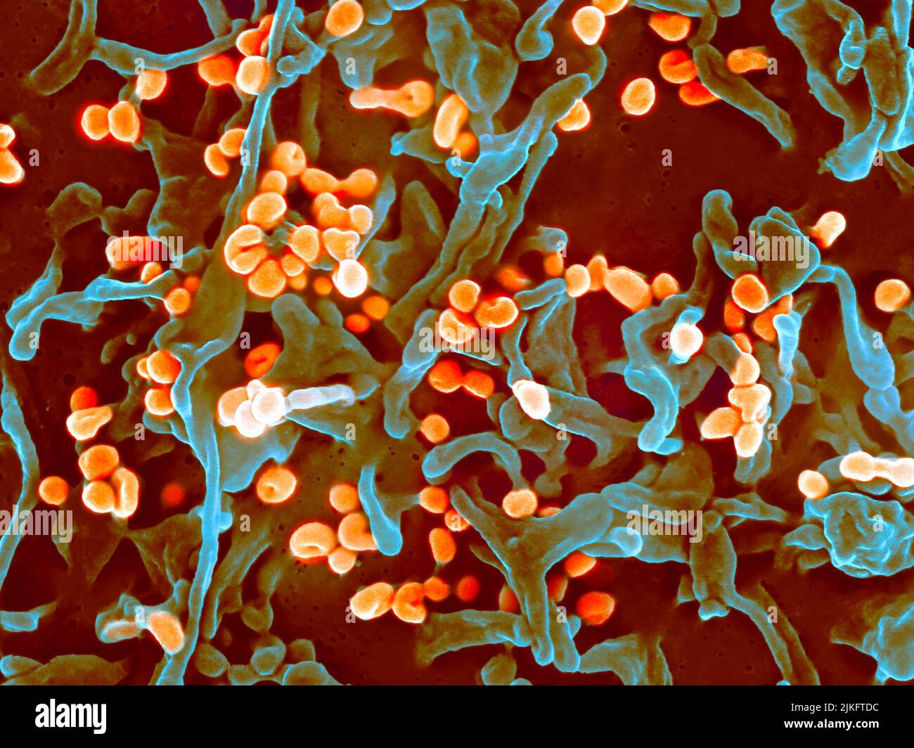 Micrographe électronique à balayage du virus de Lassa bourgeonnant sur une cellule de Vero. Banque D'Images