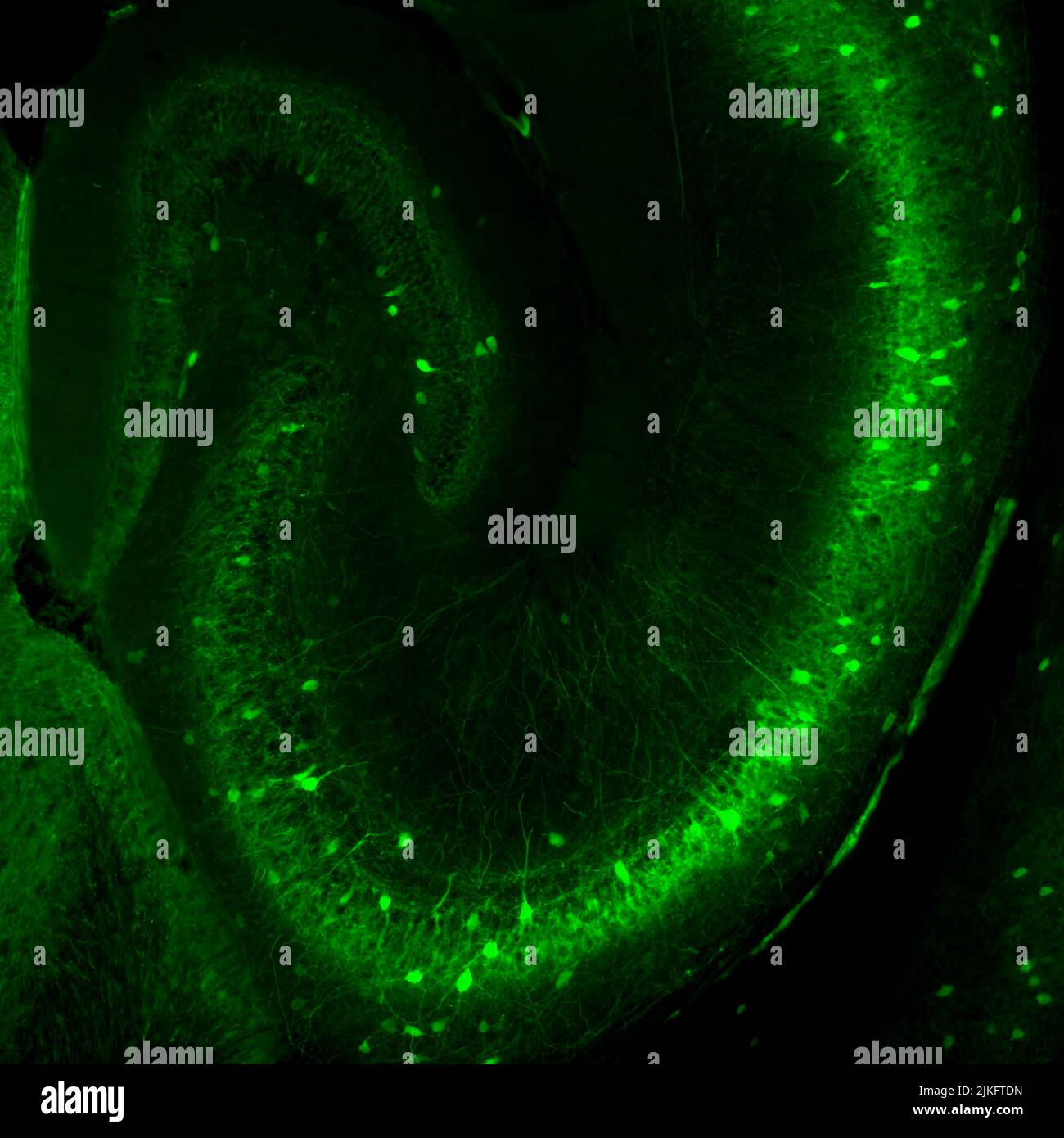 Interneurones contenant de la parvalbumine interdits de l'hippocampe de souris. Crédit : laboratoire Mcbain, NICHD/NIH Banque D'Images