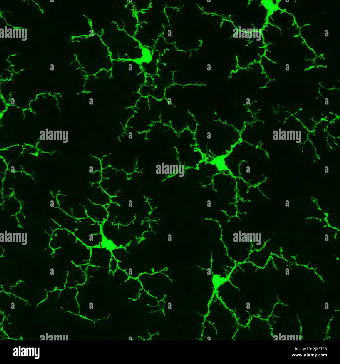 Selon une nouvelle étude menée sur les souris par des scientifiques de l'Institut National de l'oeil (NEI), les cellules immunitaires appelées microglia peuvent complètement se remplir dans la rétine après avoir été presque éliminé. Les cellules présentent également leur organisation et leur fonctionnement normaux. Les résultats indiquent des thérapies potentielles pour contrôler l'inflammation et ralentir la progression de maladies rares de la rétine telles que la rétinite pigmentaire (RP) et la dégénérescence maculaire liée à l'âge (DMLA), la cause la plus fréquente de cécité chez les Américains de 50 ans et plus. Banque D'Images