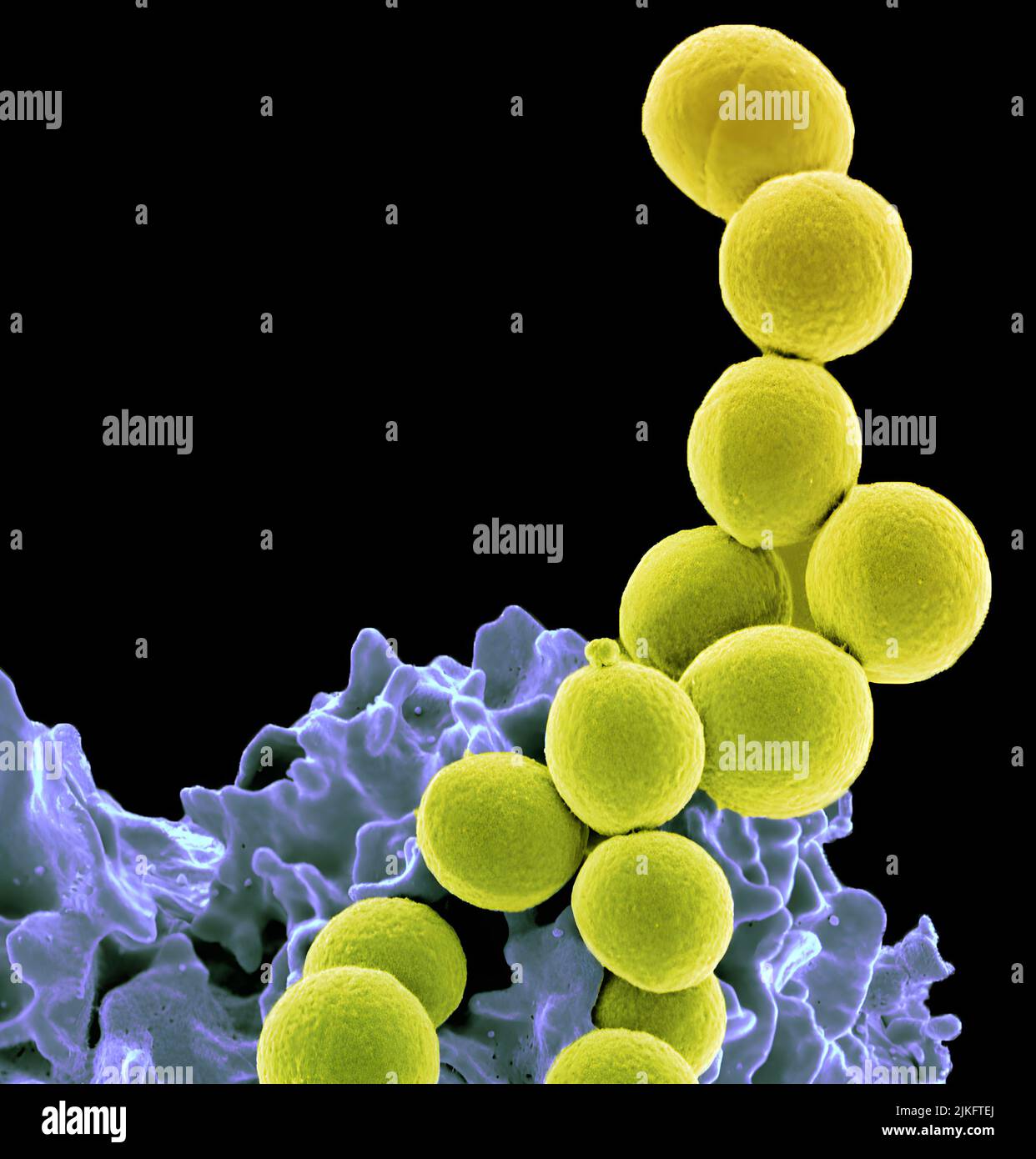 La bactérie SARM liée à un neutrophile, un type de globules blancs qui combat l'infection. Banque D'Images