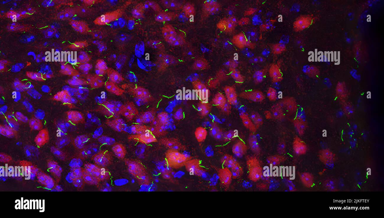 Cette image montre les neurones de souris (pourpre) avec leurs noyaux (bleu) et leurs cilia primaires (vert). Banque D'Images