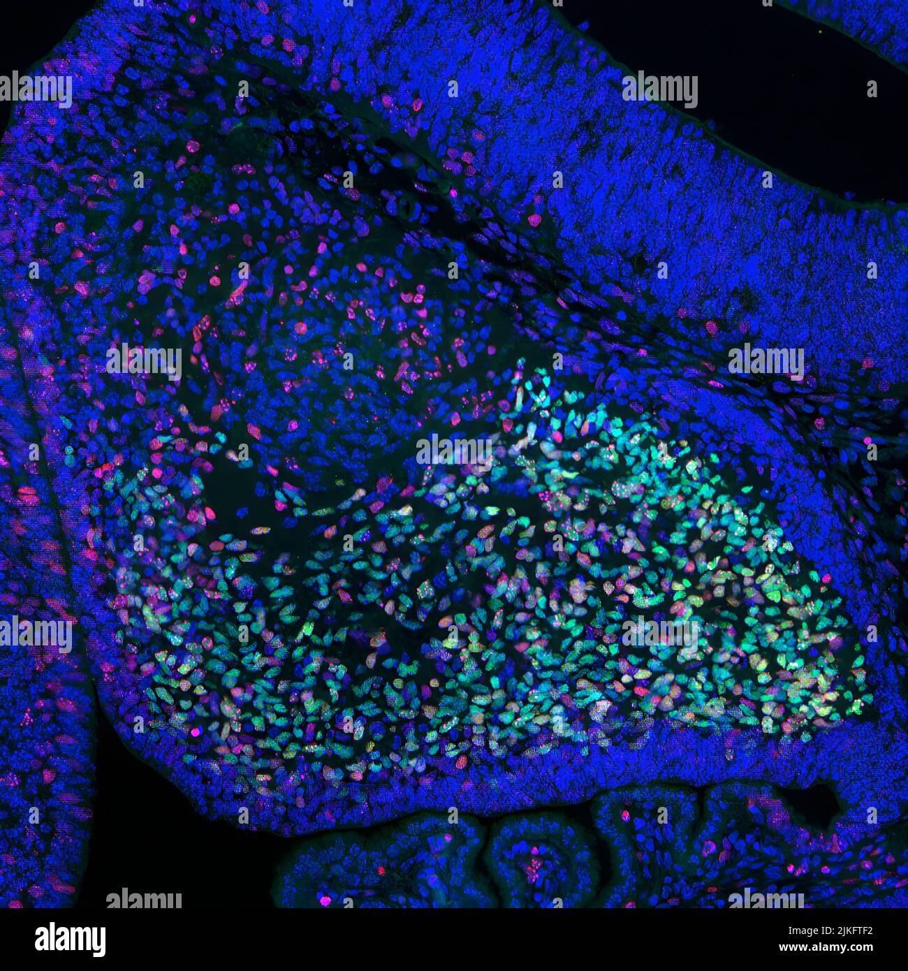 Cette photo montre le cervelet (partie du cerveau) d'un embryon de souris. Les neurones multiplicateurs sont affichés en rouge. Les cellules de Purkinje, un type spécifique de neurone important pour réguler le mouvement fin, l'équilibre et la posture, sont indiquées en vert. La couleur bleue indique tous les noyaux cellulaires. Cette image a été décernée dans le cadre d'une étude soutenue par le NIAMS sur l'effet de l'enzyme Ezh2 sur le développement des neurones dans le cerveau embryonnaire. Banque D'Images