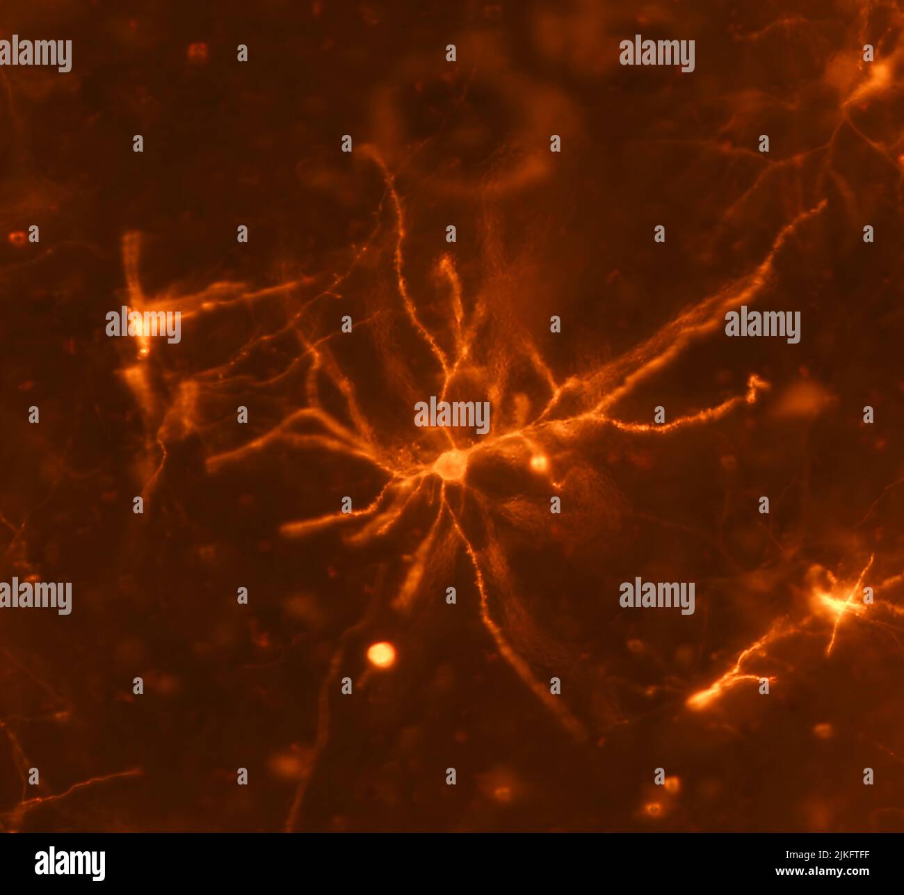 Un neurone de souris dans le striatum imagé à l'aide d'un microscope photonique à deux photons permet aux chercheurs de mesurer les changements de la colonne vertébrale dendritique et leur influence sur la dépendance. Banque D'Images