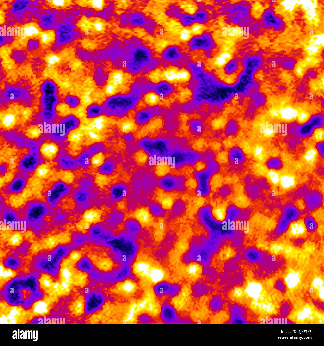 Les cellules de l'épithélium pigmentaire rétinien (RPE) forment des patrons uniques qui peuvent être utilisés pour suivre les changements dans cette importante couche de tissu à l'arrière de l'œil, ont constaté des chercheurs de l'Institut National de l'oeil (NEI). À l'aide d'une combinaison d'imagerie optique adaptative et d'un colorant fluorescent, les chercheurs ont utilisé les profils RPE pour suivre les cellules individuelles chez des volontaires sains et des personnes atteintes d'une maladie de la rétine. La nouvelle découverte pourrait permettre d'étudier la progression et le traitement des maladies aveuglantes qui causent le RPE. Banque D'Images