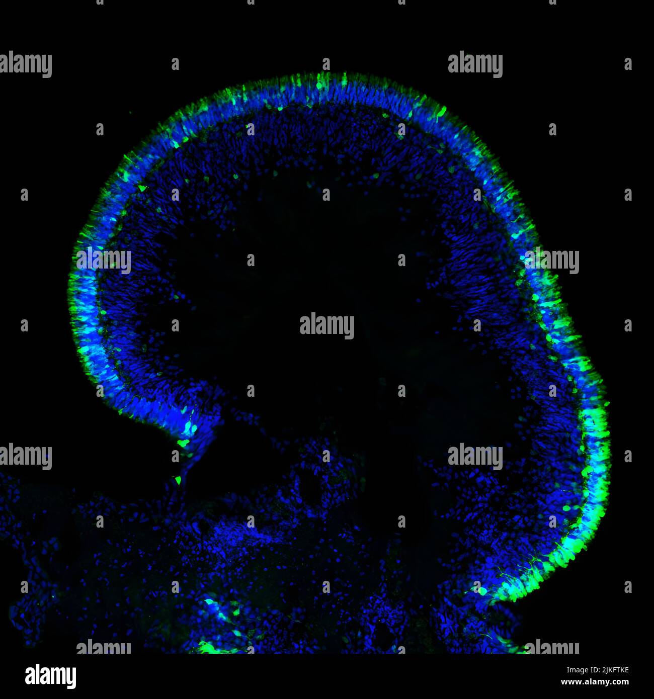 Les scientifiques de l'Institut National de l'oeil du NIH ont développé une stratégie prometteuse de thérapie génique pour une forme d'amaurose congénitale (ACL) de Leber, une maladie rare qui provoque une perte sévère de la vision chez les enfants. Les scientifiques ont testé leur approche à l'aide de tissus rétiniens fabriqués en laboratoire à partir de cellules de patients, appelés organoïdes rétiniens, dont l'un est illustré ici. Banque D'Images