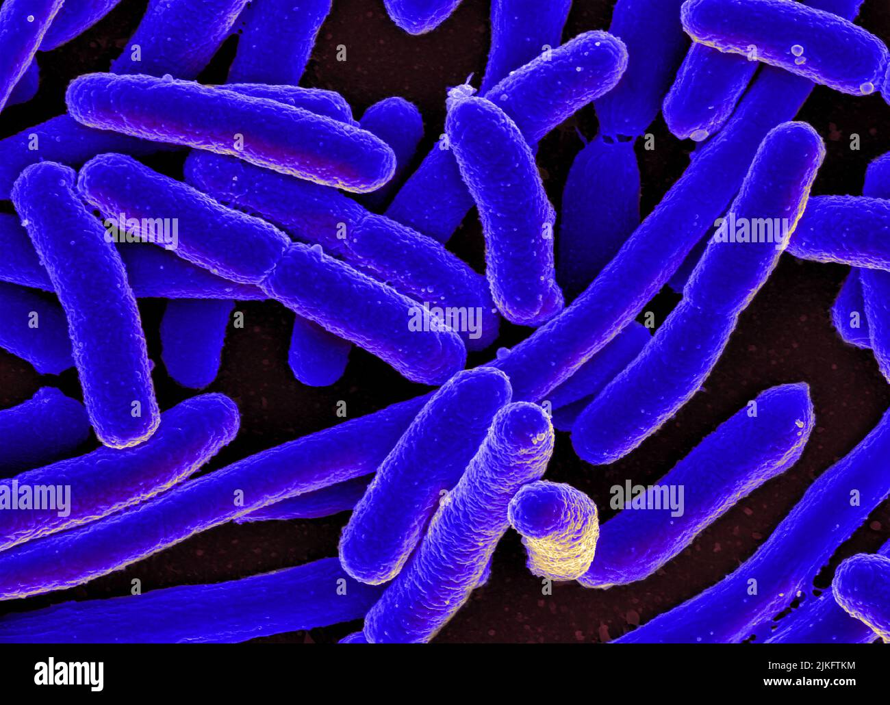 Micrographe électronique à balayage d'Escherichia coli Banque D'Images