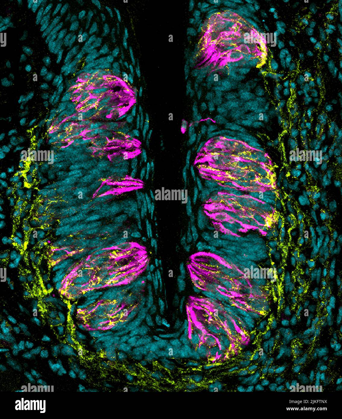 Une structure sur la langue un bourgeon de goût contient des bourgeons de goût (rose) qui envoient des informations au cerveau par des fibres nerveuses de goût (jaune). Chaque bourgeon de goût de cellules qui répond à des goûts spécifiques doux, amer, umami, salé, aigre ou gras contient. Les chercheurs étudient comment les papilles sont submergées à l'âge adulte. Les personnes qui ne régénèrent pas entièrement leurs papilles en raison d'un traitement contre le cancer, par exemple, peuvent souffrir d'une perte d'appétit et de malnutrition. Banque D'Images