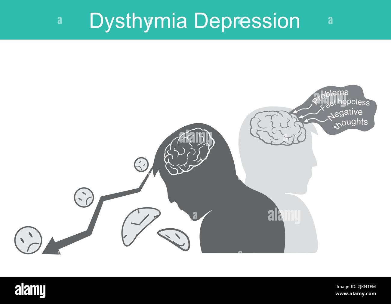Dysthymie Dépression. Illustration de la psychologie dans l'éducation cerveau et comportement dépression d'un patient. Illustration de Vecteur