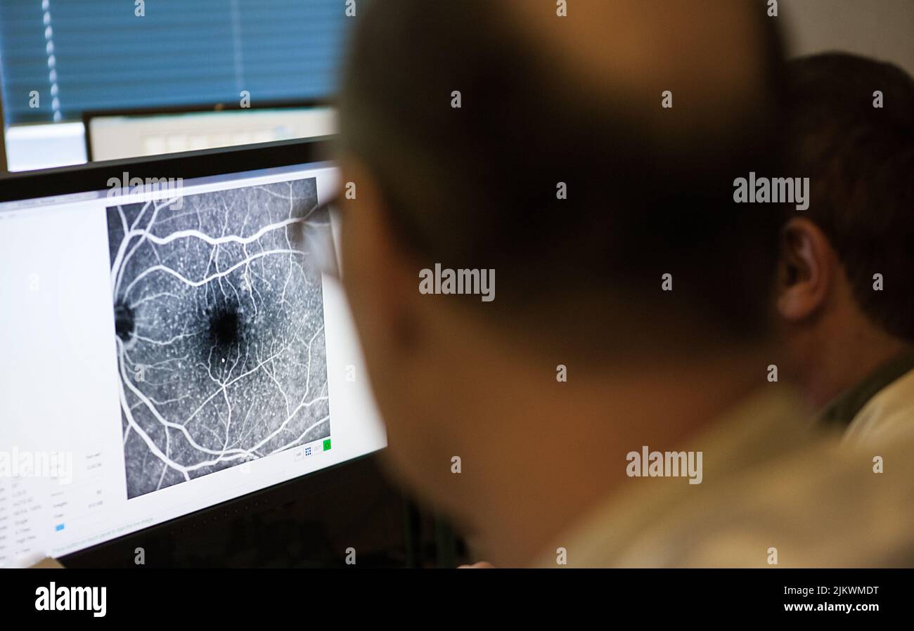Angiographie des yeux Banque de photographies et d’images à haute