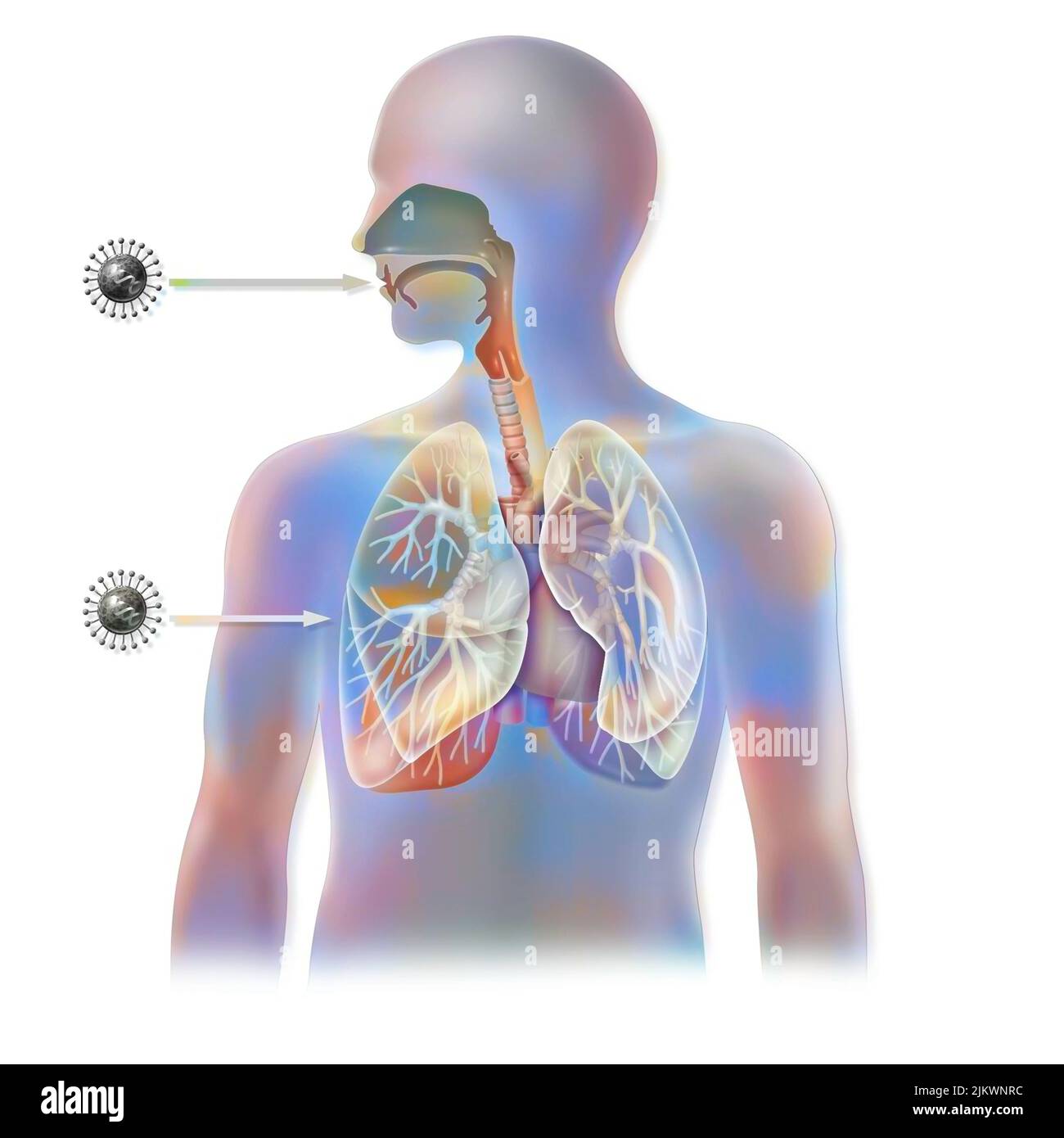 Comparaison des régions infectées par le virus de l'influenza humaine et aviaire. Banque D'Images