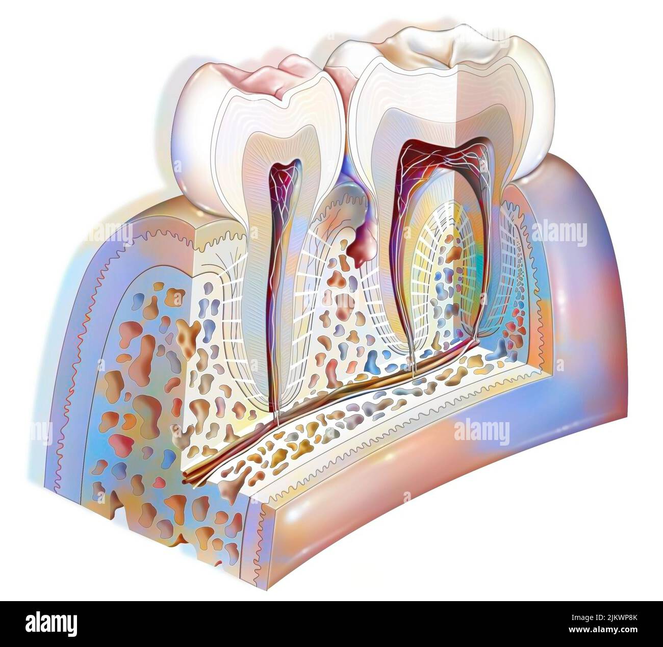 Plaque dentaire: Pathologies principales des dents: Tartre, gingivite. Banque D'Images