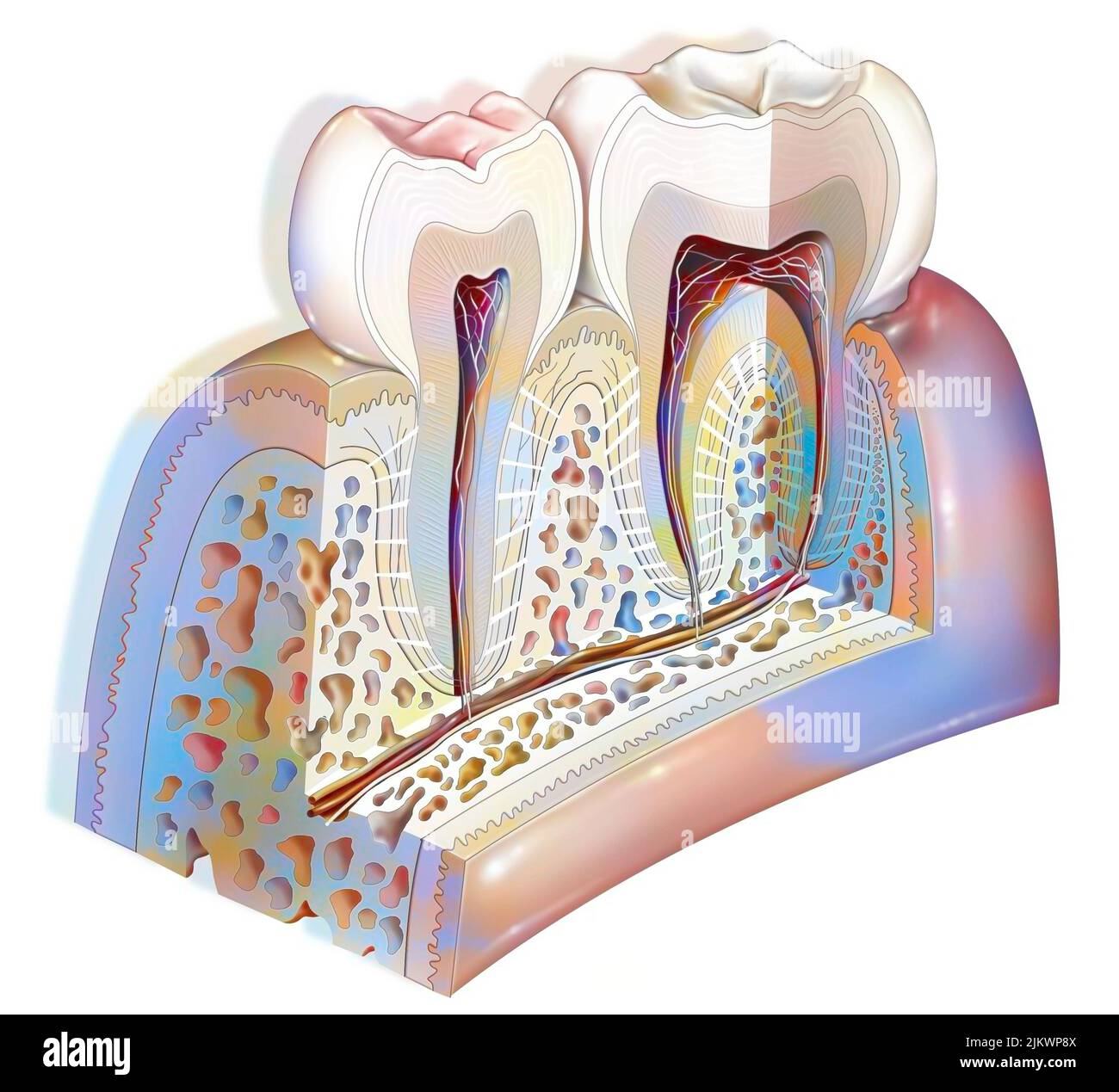 Plaque dentaire: Pathologies principales des dents: Tartre, gingivite. Banque D'Images