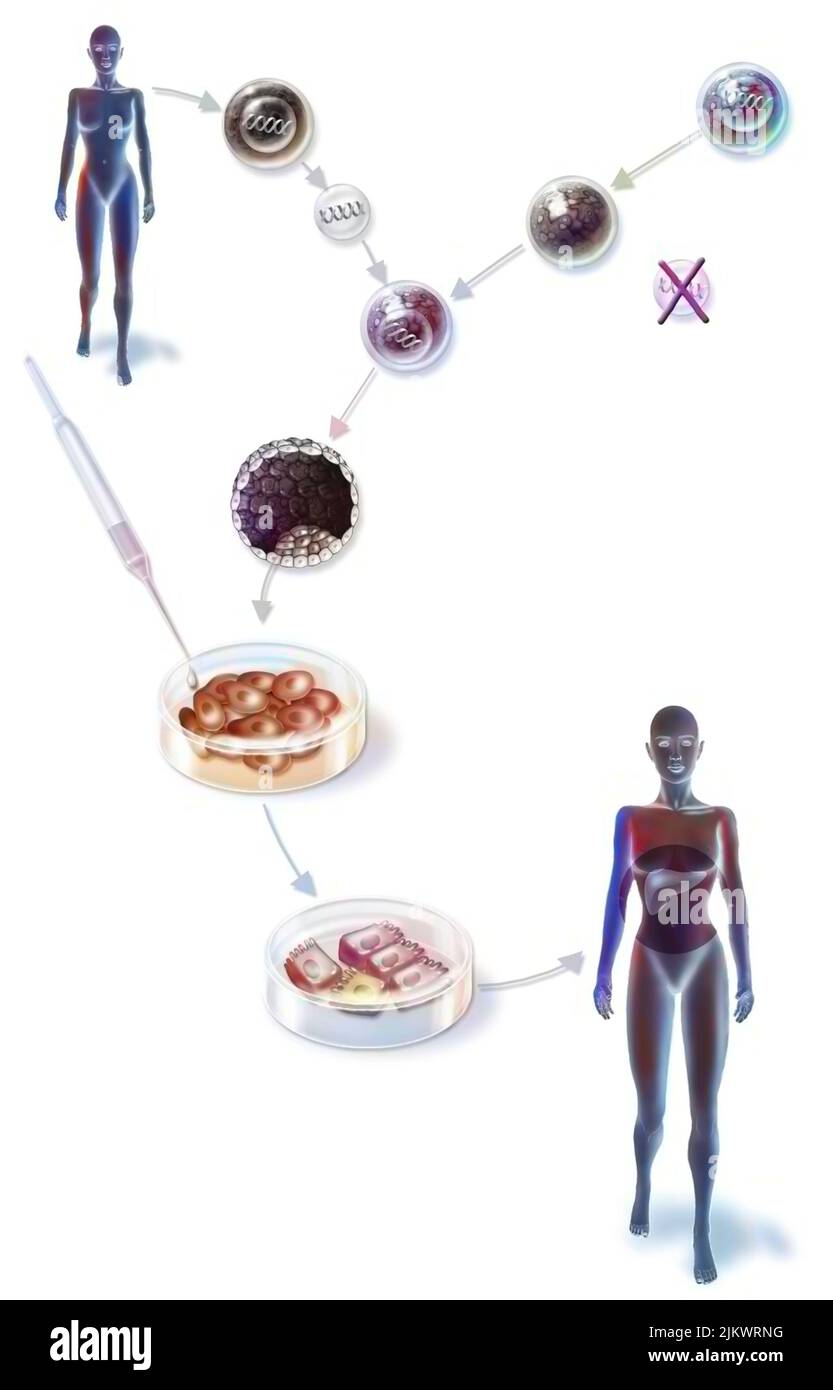 Fabrication de cellules hépatiques à partir de l'ADN d'un patient. Banque D'Images