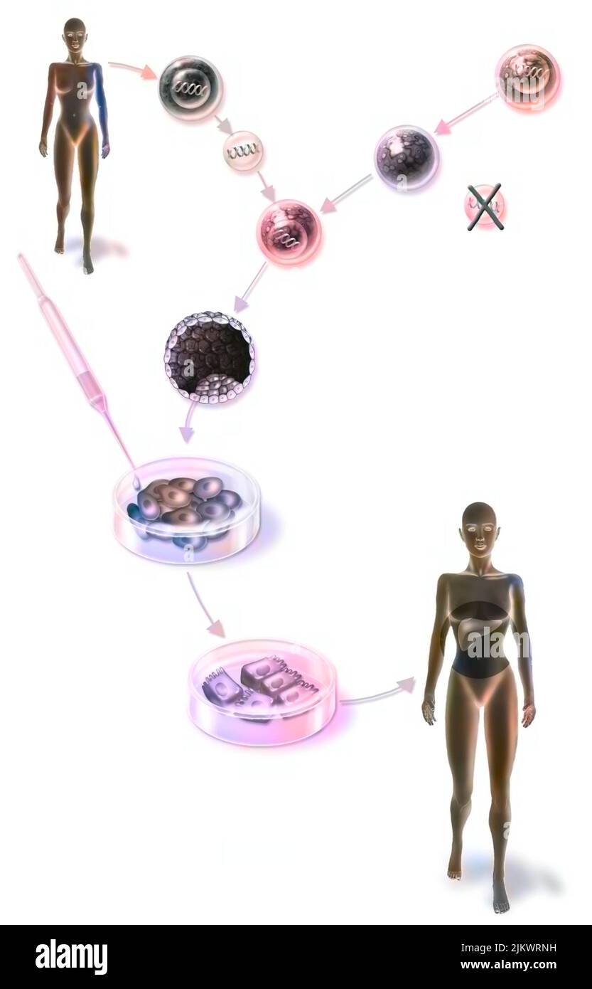 Fabrication de cellules hépatiques à partir de l'ADN d'un patient. Banque D'Images