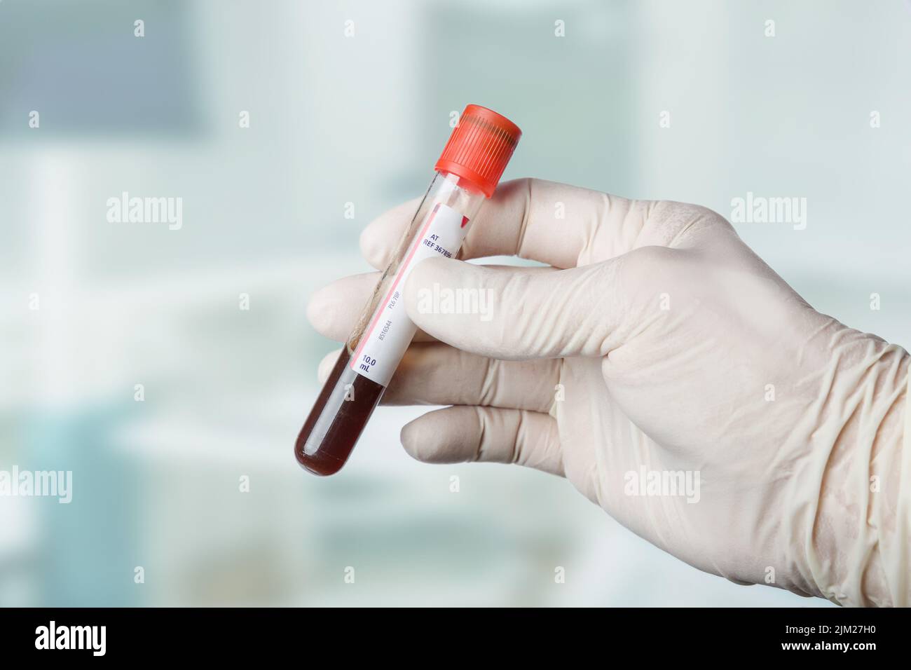 gros plan d'une main dans des gants médicaux pour manipuler une sonde de sang Banque D'Images
