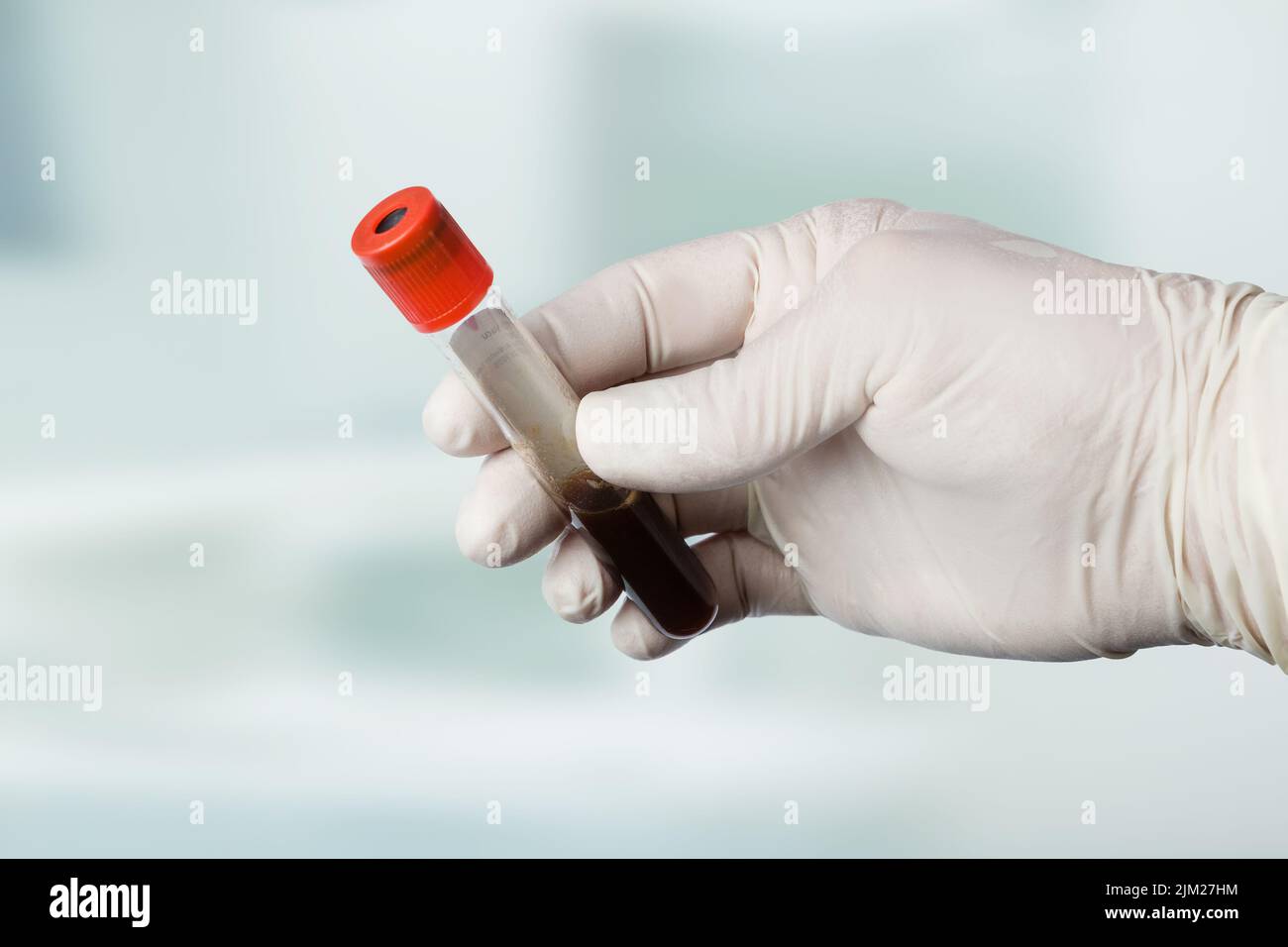 gros plan d'une main dans des gants médicaux pour manipuler une sonde de sang Banque D'Images
