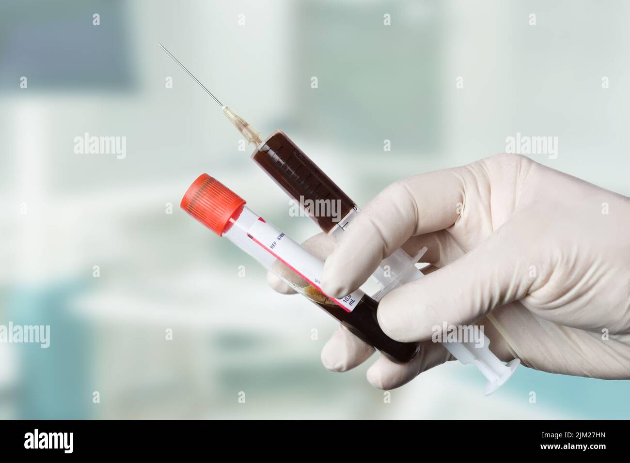gros plan d'une main dans des gants médicaux pour manipuler une sonde de sang et une seringue Banque D'Images