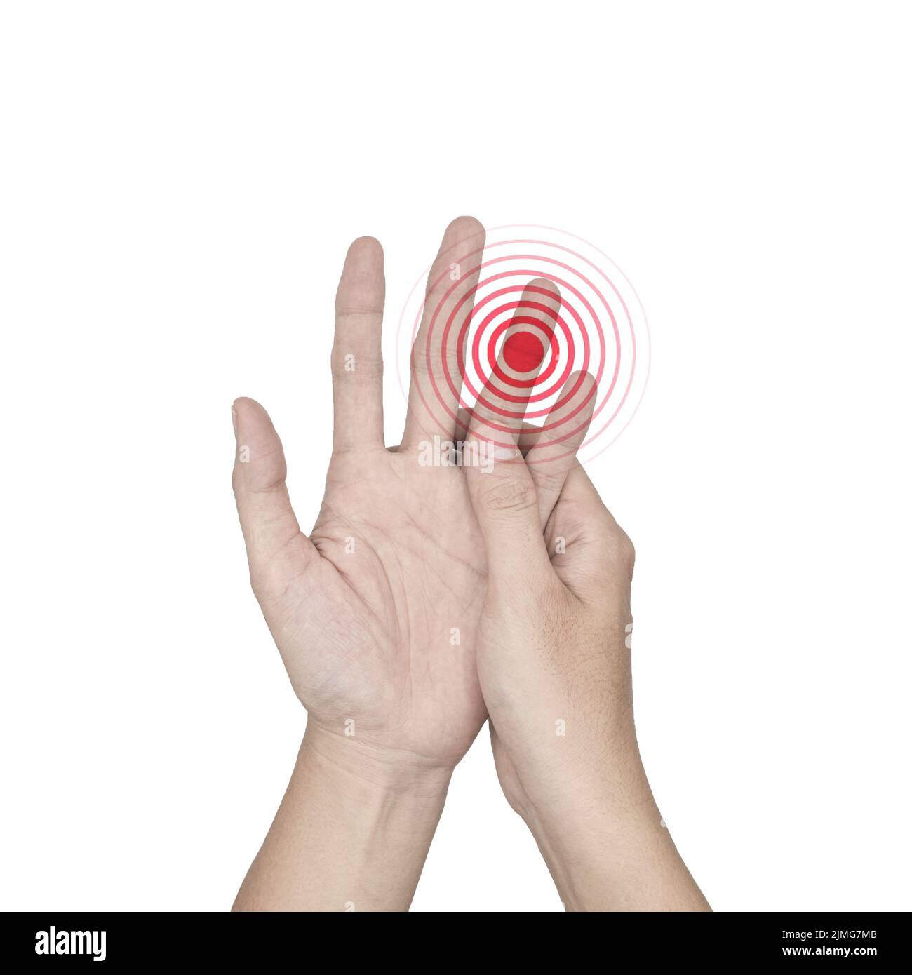 Inflammation de l'articulation des doigts. Concept d'arthrite ou de cellulite. Isolé sur blanc. Banque D'Images