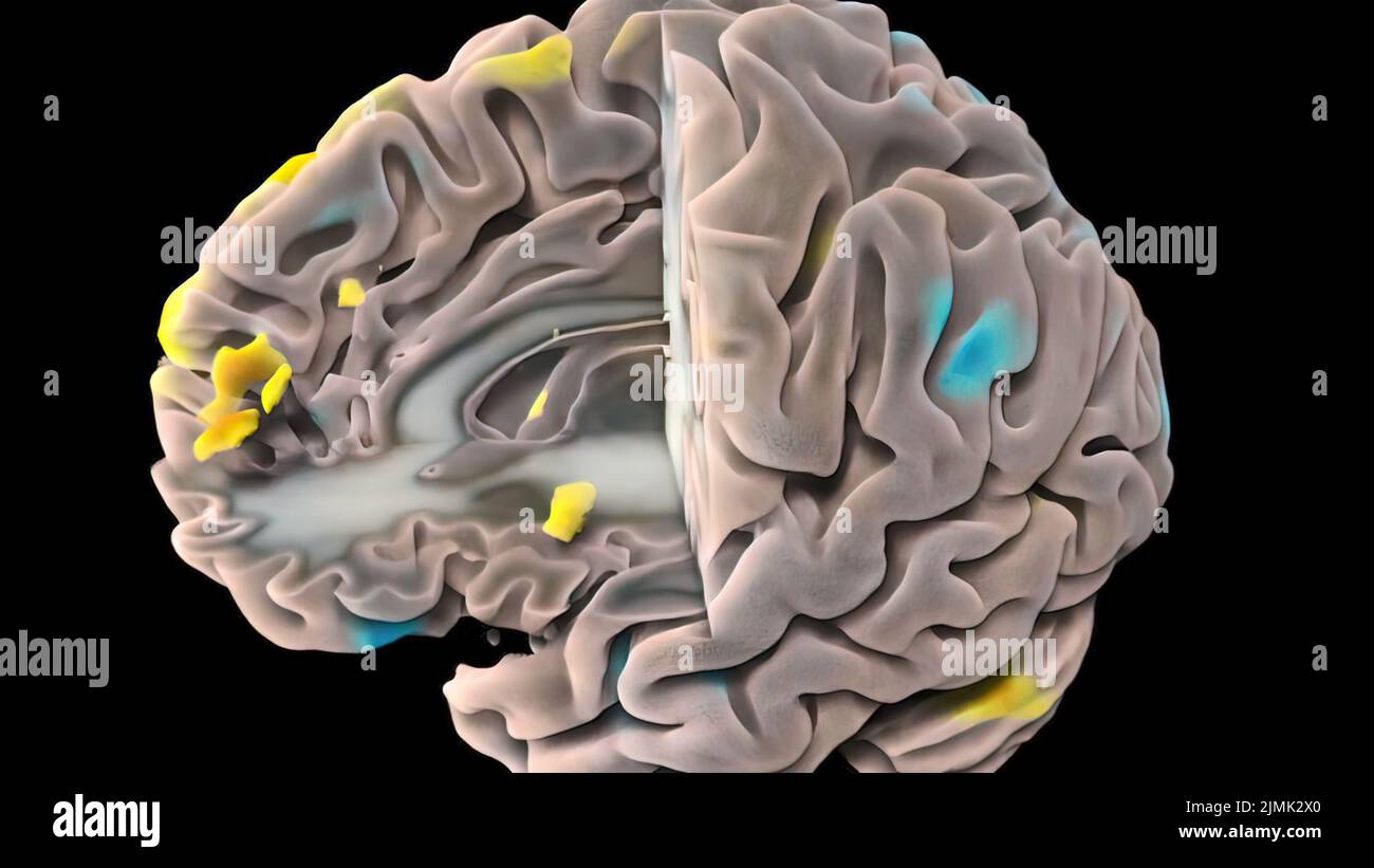 3D médical 3D illustration de l'activité neuronale du cerveau humain Banque D'Images