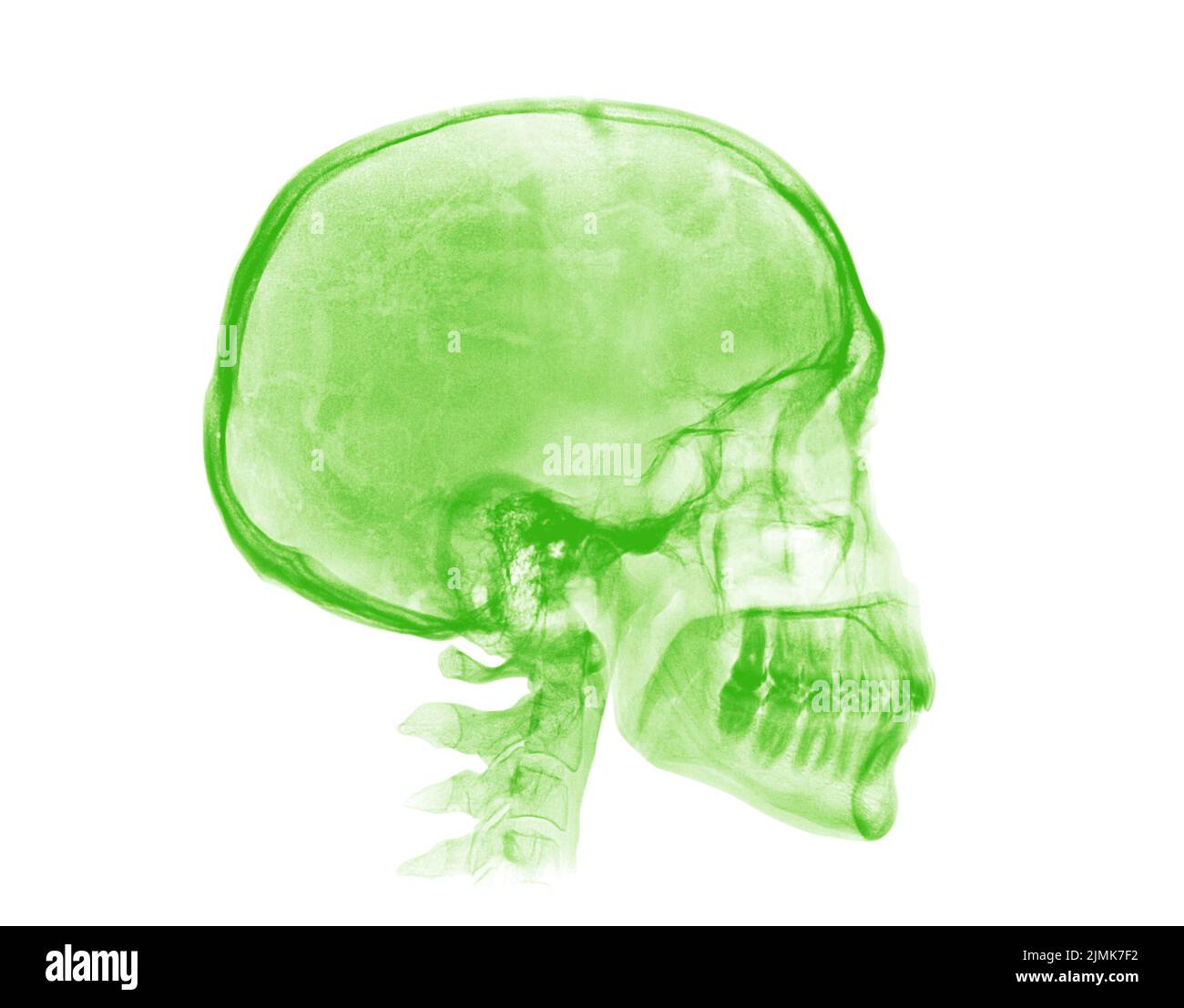 Crâne humain. Image radiologique verte sur fond blanc Banque D'Images