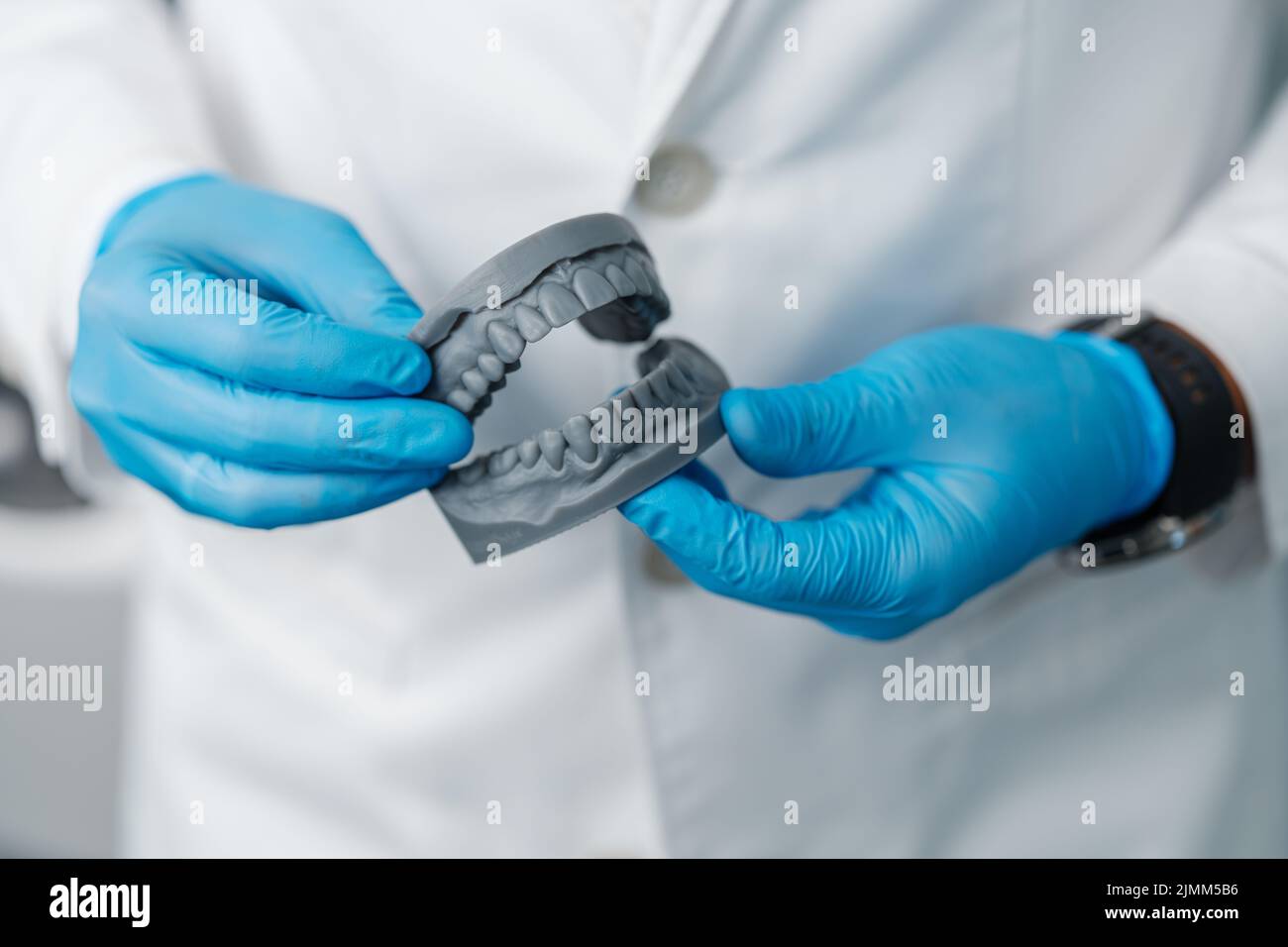 Mâchoire supérieure et inférieure d'un homme imprimée sur une imprimante 3D de photopolymère Banque D'Images