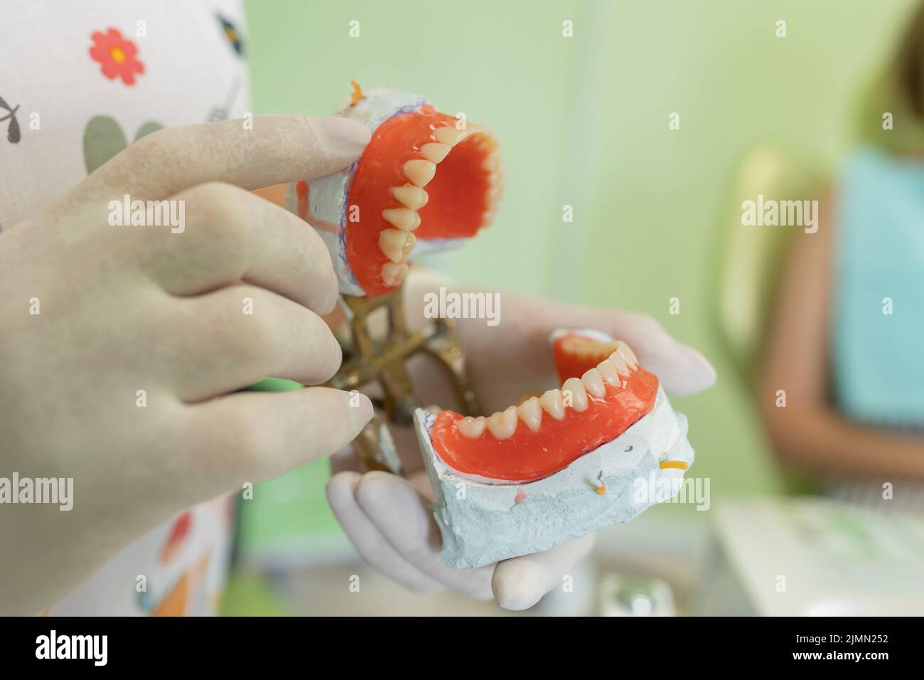 Le dentiste tient des prothèses dentaires entre ses mains.Prothèse dentaire dans les mains du médecin en gros plan.Vue avant de la prothèse complète.Concept de dentisterie Banque D'Images