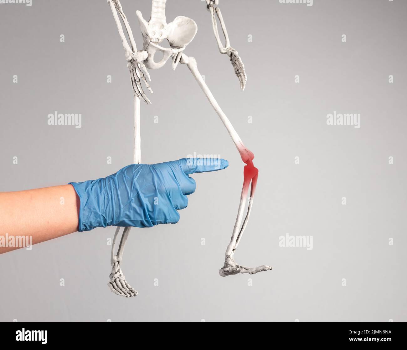 Main du médecin pointant vers le genou squelette avec un point rouge. Douleur à la jambe. Ligaments tentainés, rompus, déchirure du ménisque, tendinite, arthrite. Système squelettique an Banque D'Images
