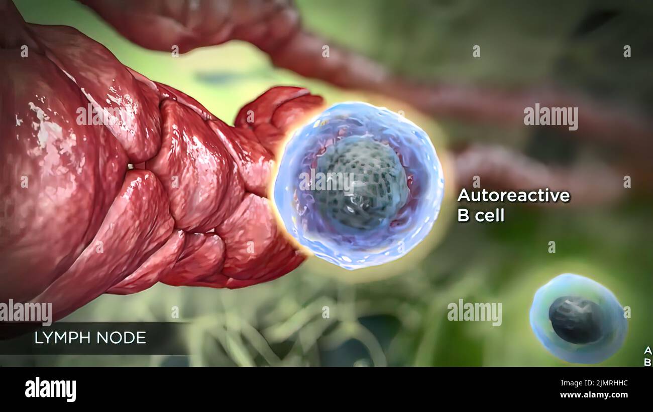 Ganglions lymphatiques du cou Banque de photographies et d’images à haute résolution Alamy