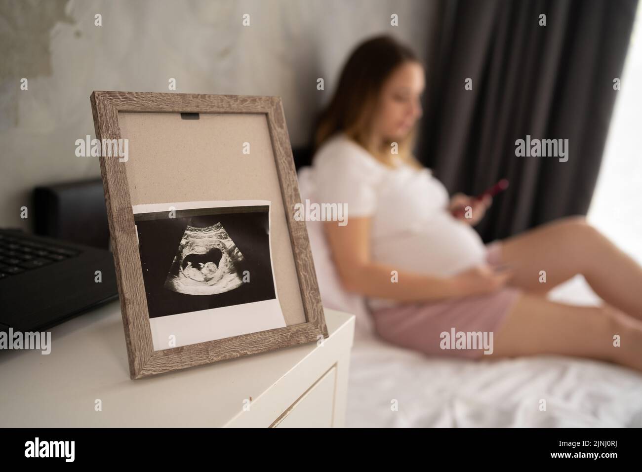 échographie photo du fœtus dans le cadre, femme enceinte au lit
