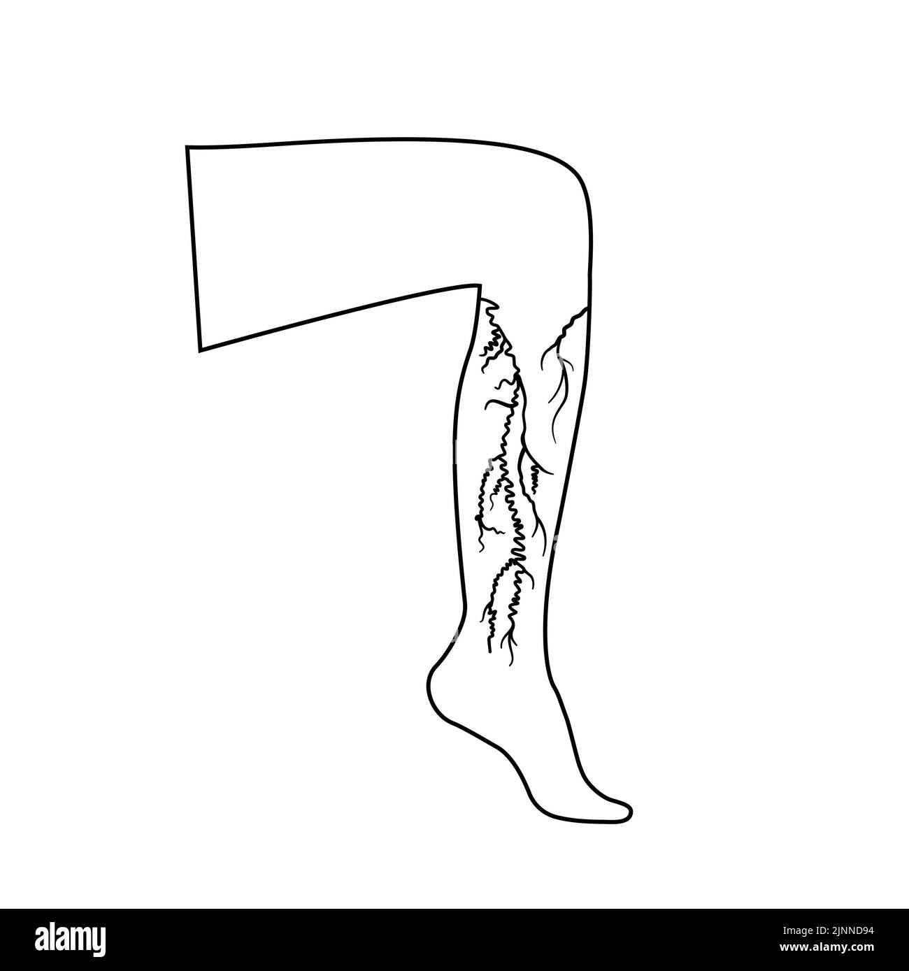 Varices, illustration Banque D'Images