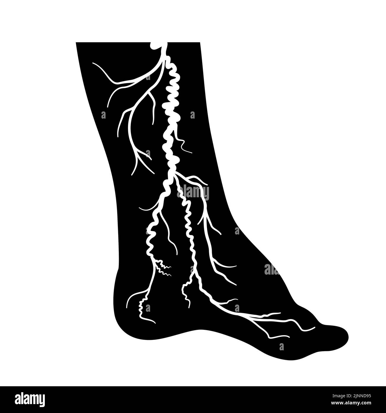 Varices, illustration Banque D'Images