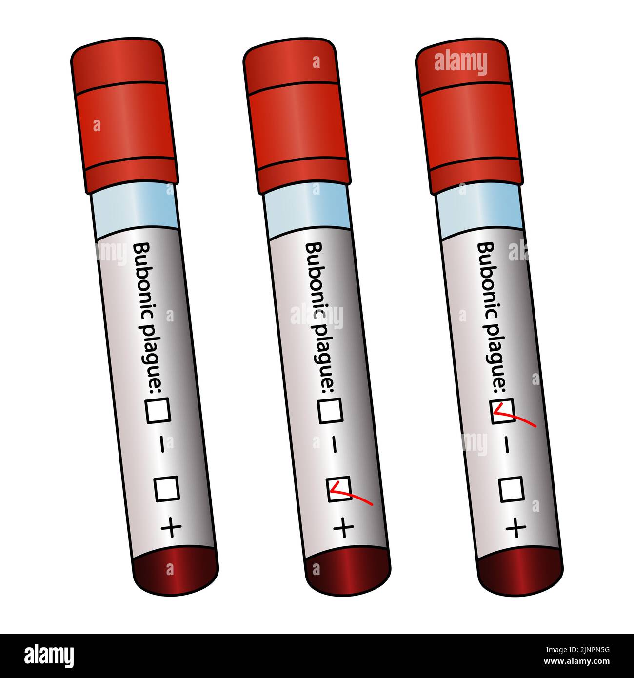 Tubes à essai avec analyses de patients. Jeu de vecteurs de couleur. Diagnostic d'échantillons de sang pour la peste bubonique. Trois résultats : positif, négatif, non préparé. Illustration de Vecteur