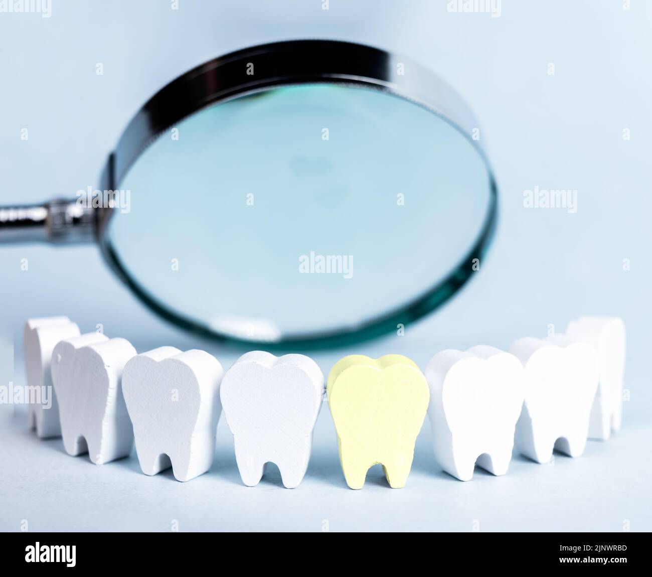 Une dent avec caries, détection de dents malsaines. Photo de haute qualité Banque D'Images