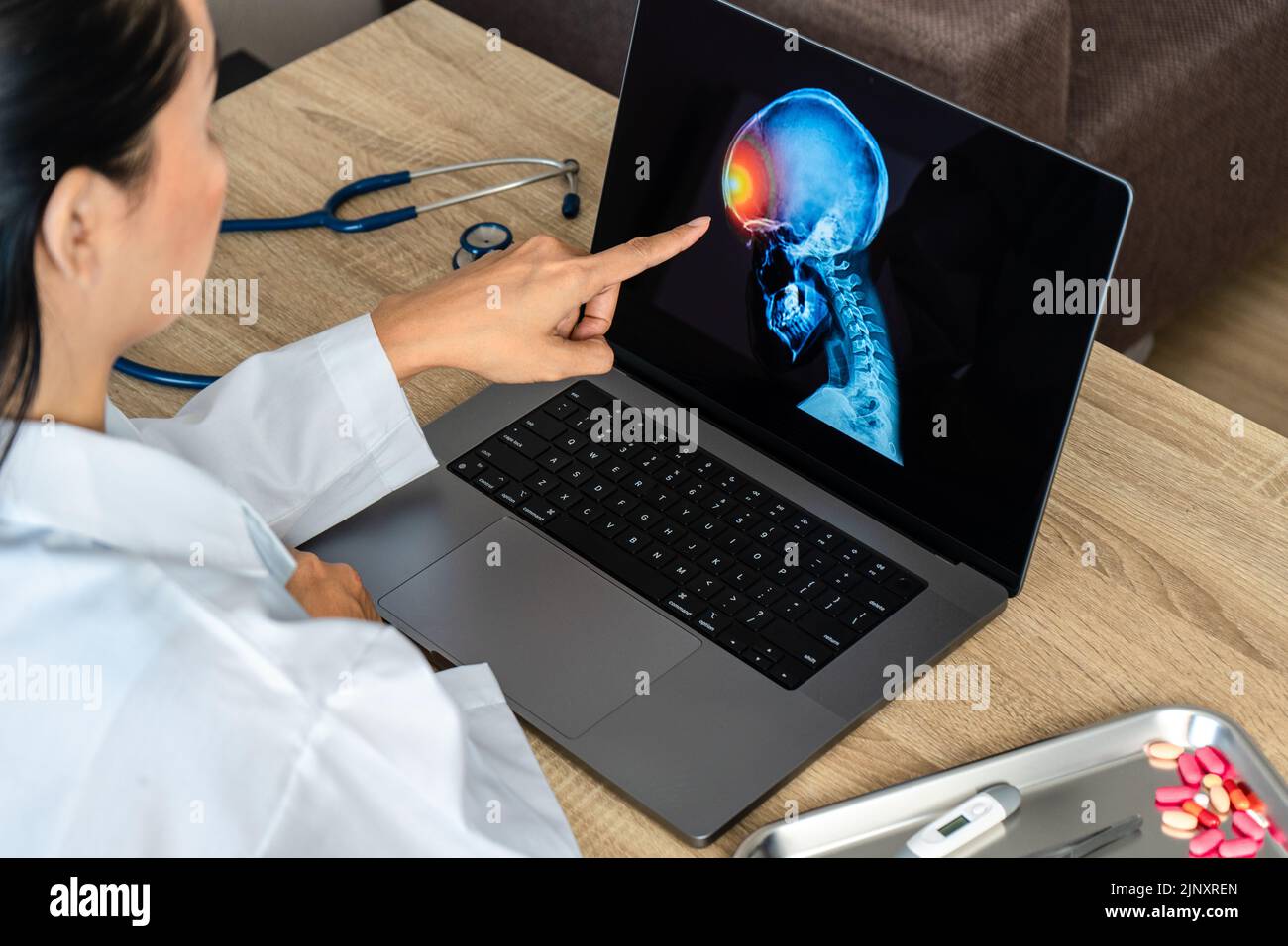 Médecin montrant une radiographie de la douleur dans le cerveau sur un ordinateur portable. Migraine Banque D'Images
