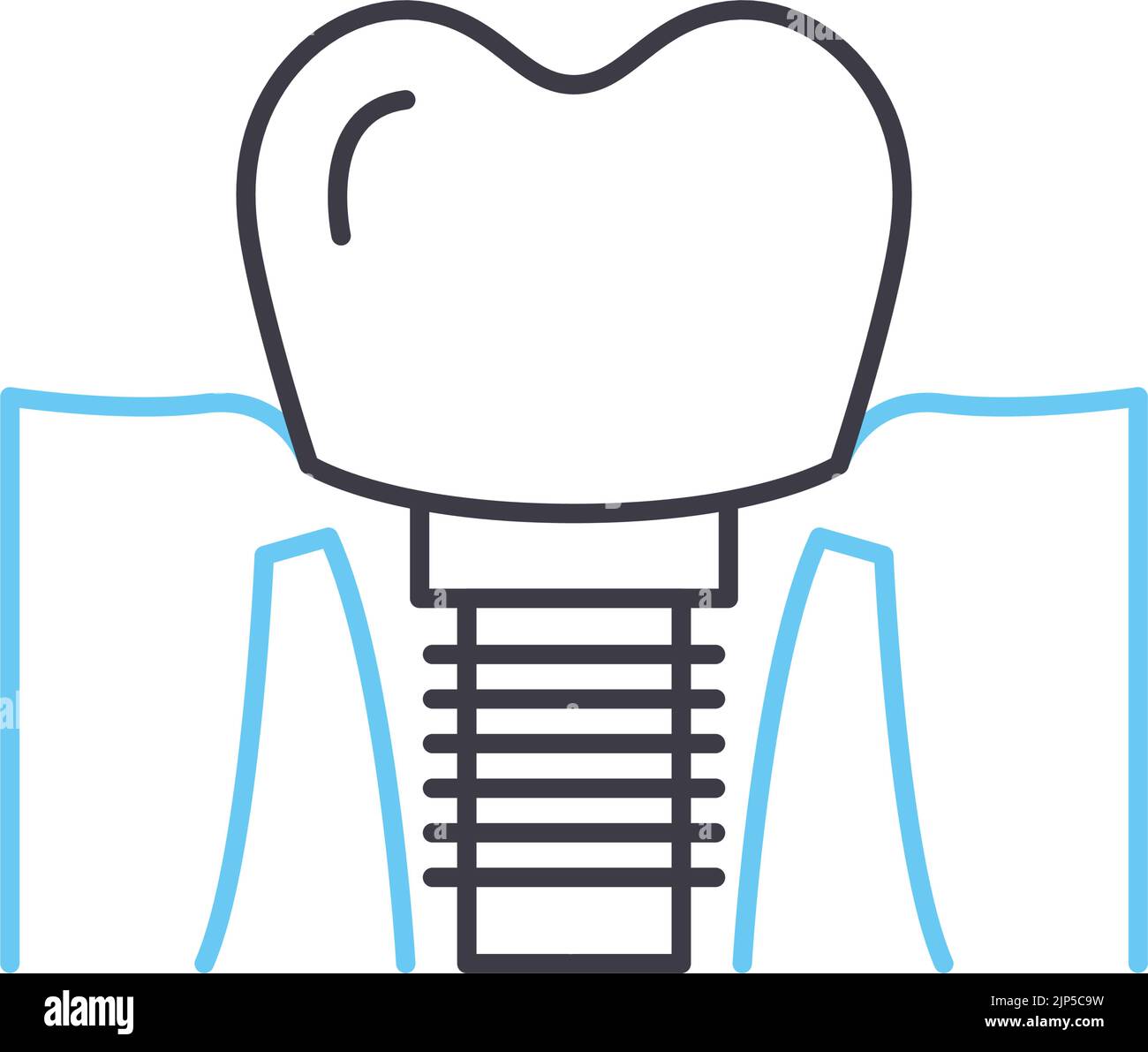 icône de ligne d'implants dentaires, symbole de contour, illustration vectorielle, signe de concept Illustration de Vecteur