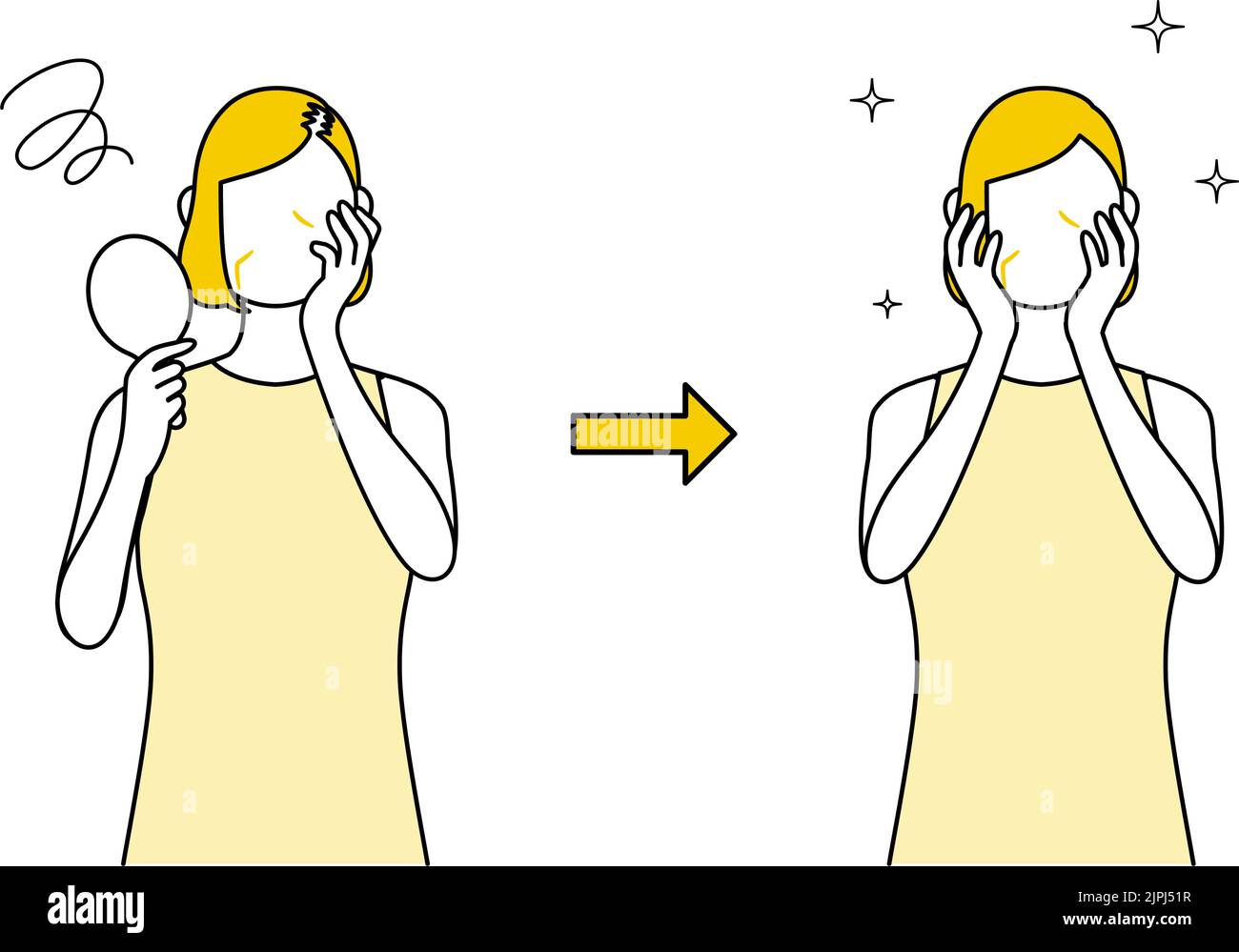 Avant et après les femmes traitant des femmes pour AGA, amincissement des cheveux, et perte de cheveux Illustration de Vecteur