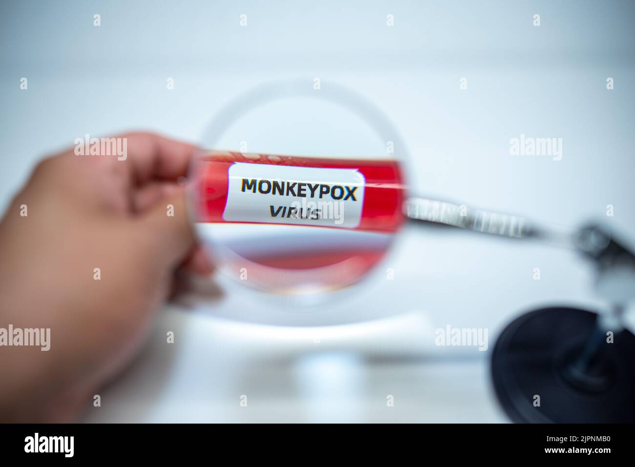 Gros plan du tube d'échantillon de sang positif avec le virus de la variole du singe, nouvelle maladie épidémique en 2022. Banque D'Images