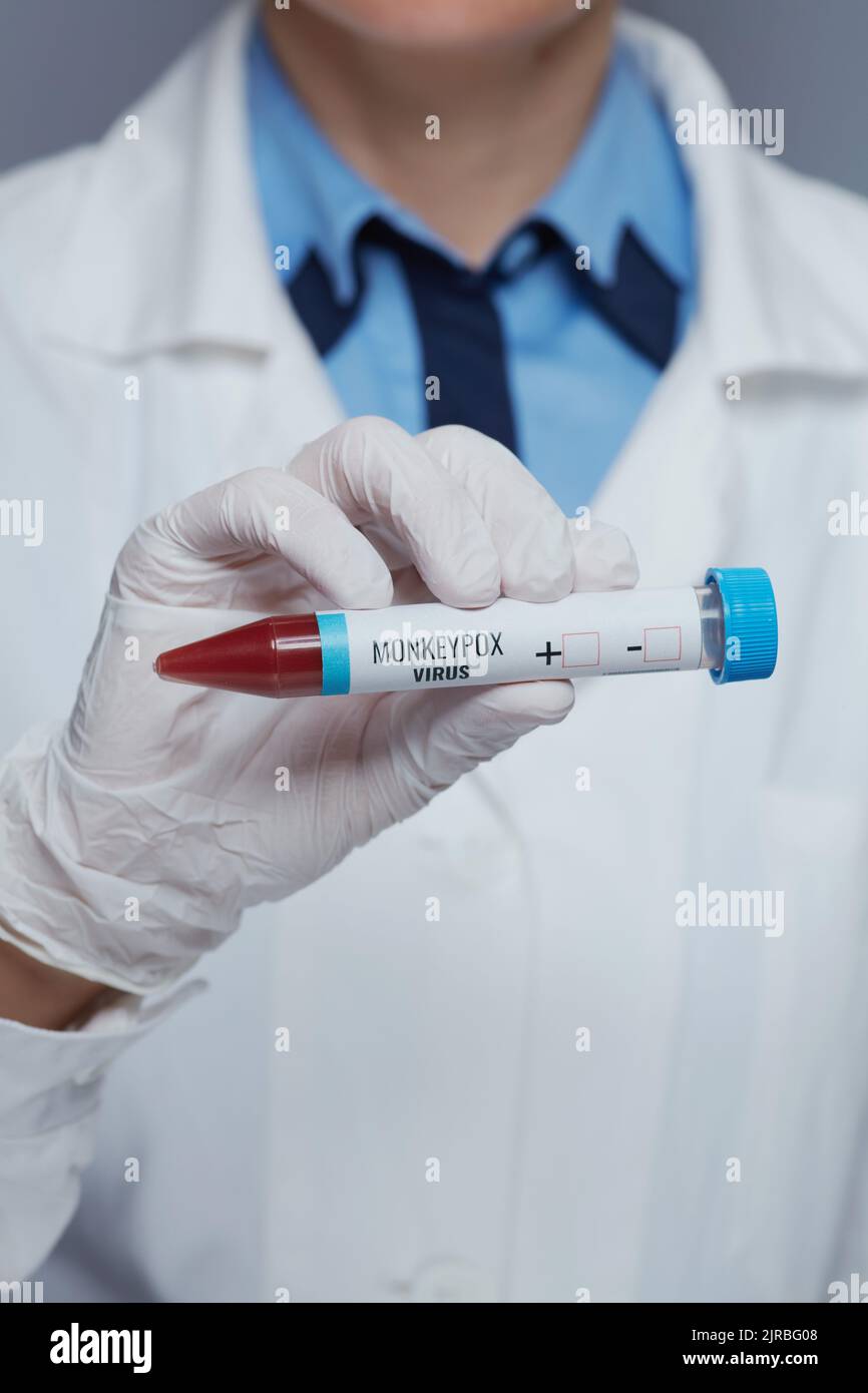 Gros plan sur le médecin moderne femme en robe médicale blanche avec tube de test de la monkeypox isolé sur fond gris. Banque D'Images