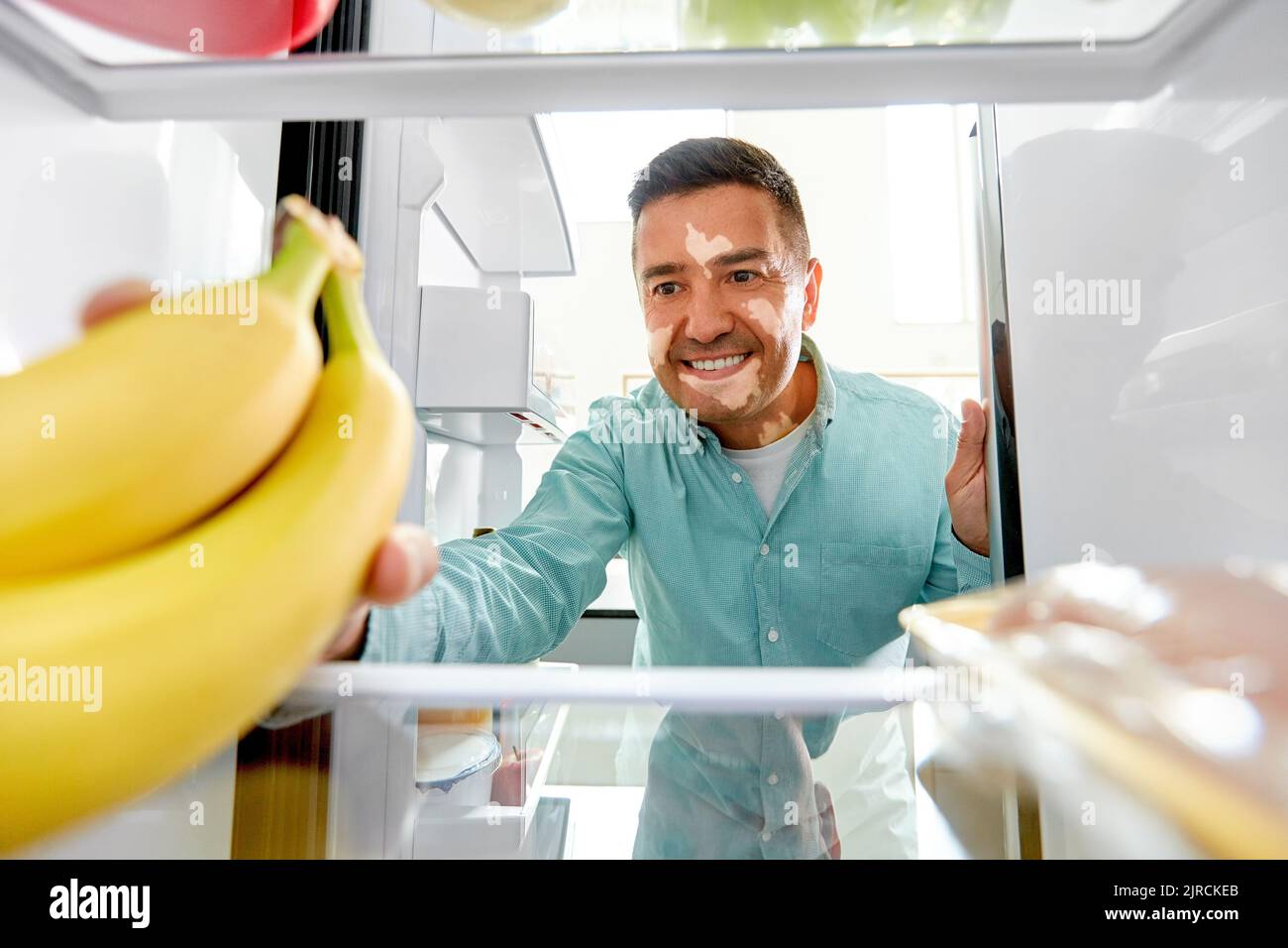 homme avec vitiligo prenant la banane du réfrigérateur Banque D'Images