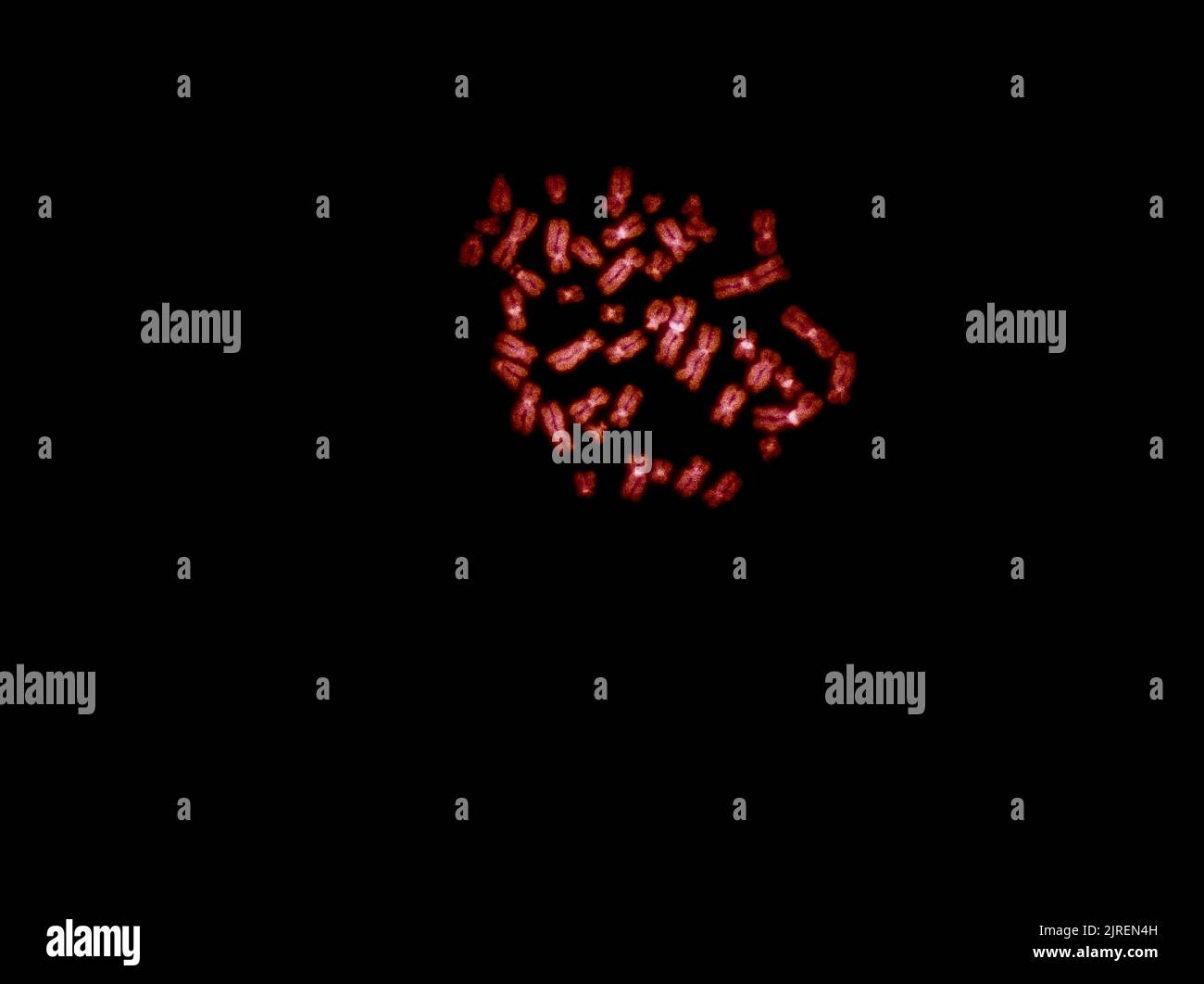 Chromosomes sous microscope à fluorescence, chromosomes humains de couleur rouge provenant du sang Banque D'Images