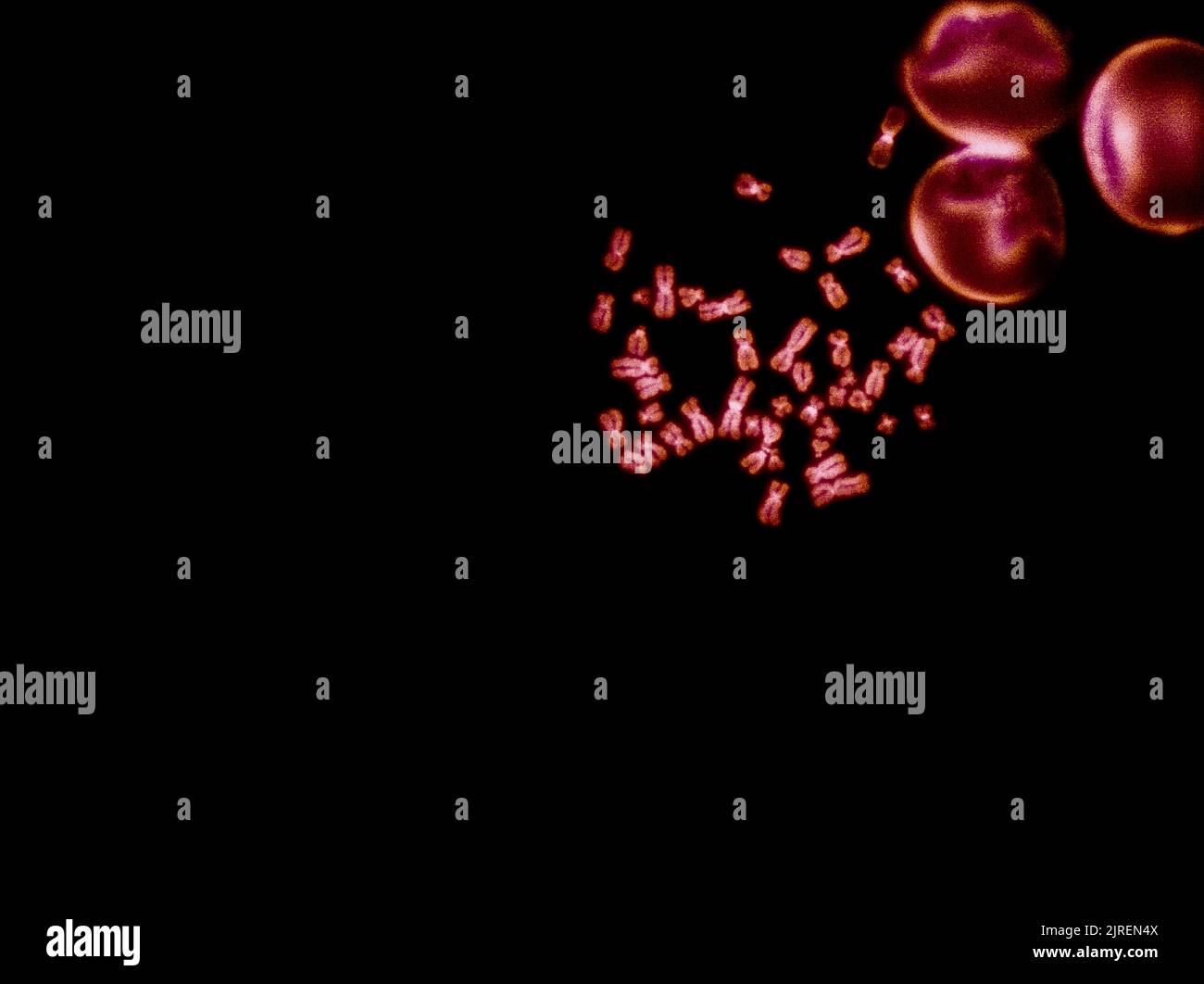 Chromosomes sous microscope à fluorescence, chromosomes humains de couleur rouge provenant du sang Banque D'Images