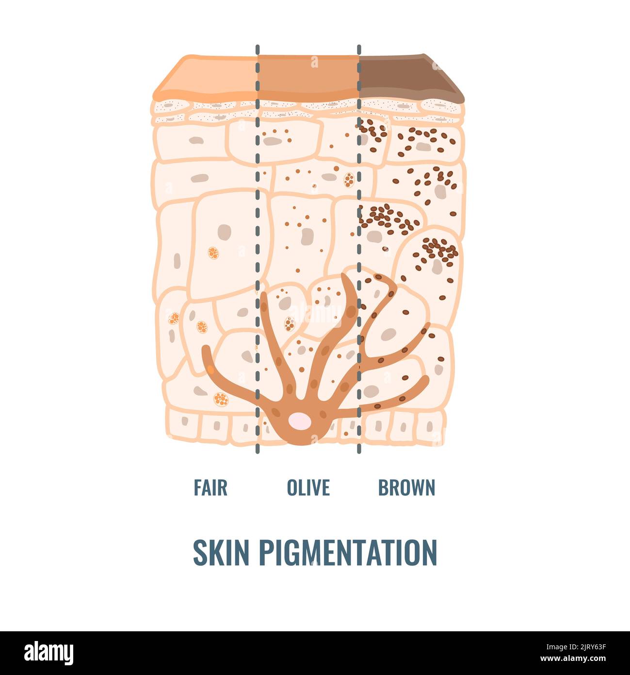 Pigmentation de la peau, illustration Banque D'Images