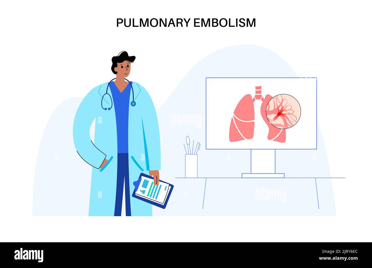 Traitement de l'embolie pulmonaire, illustration Banque D'Images