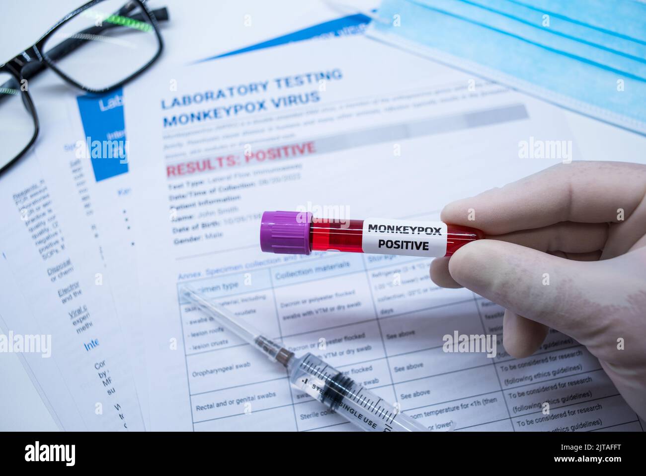 Les tubes de prélèvement sanguin et la fiche technique sur les résultats positifs des tests de la variole du singe en laboratoire Banque D'Images