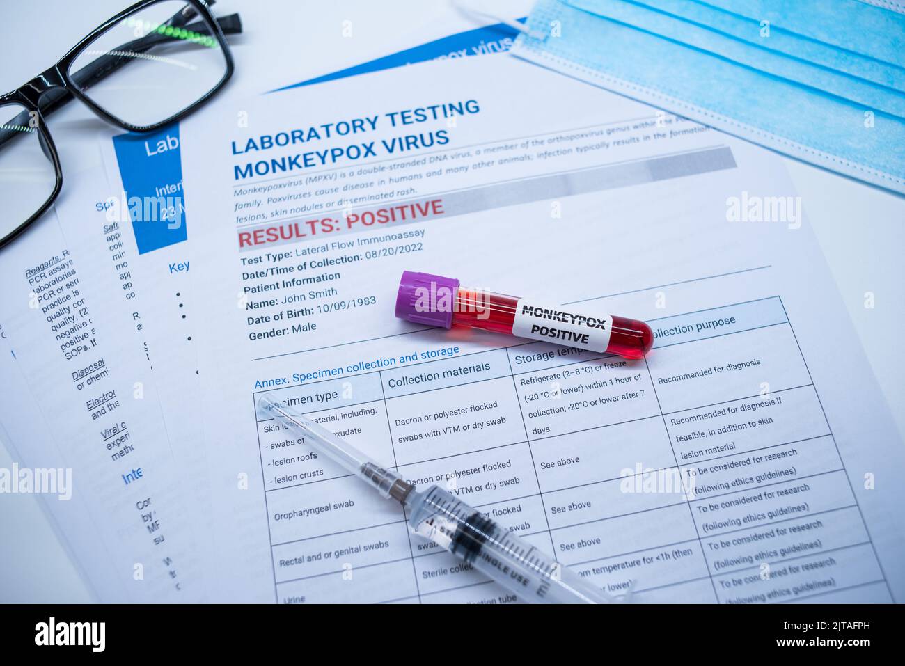 Les tubes de prélèvement sanguin et la fiche technique sur les résultats positifs des tests de la variole du singe en laboratoire Banque D'Images