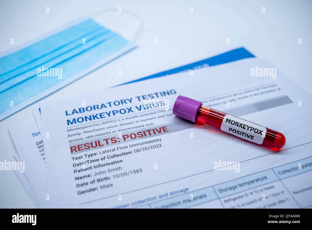 Les tubes de prélèvement sanguin et la fiche technique sur les résultats positifs des tests de la variole du singe en laboratoire Banque D'Images