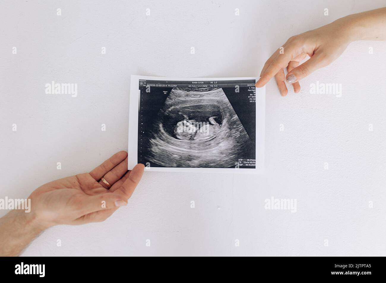 Les parents d'un couple ont un cliché échographique de leur futur bébé dans l'utérus. Concept de l'amour et des soins pendant la grossesse, l'attente et le bébé né. Banque D'Images